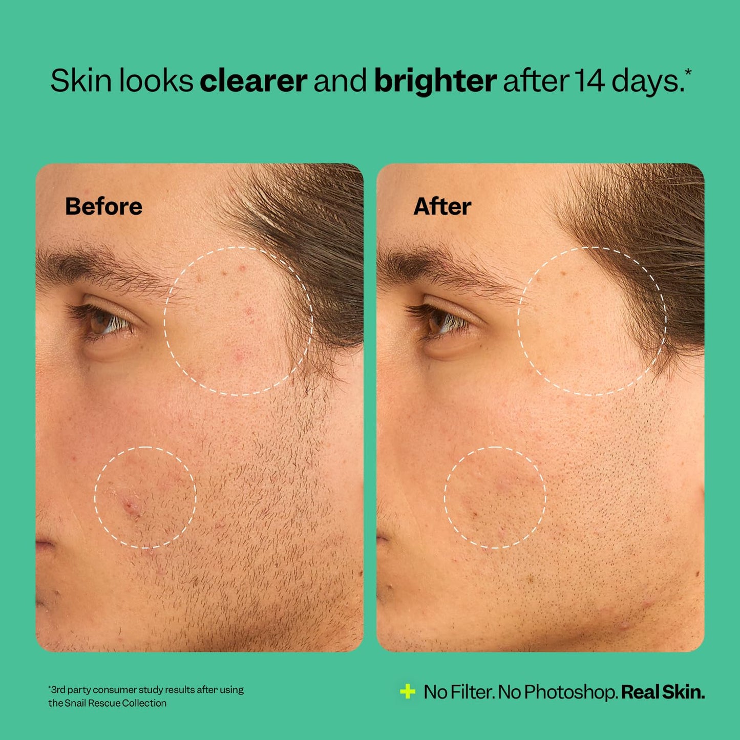 Peach Slices Snail Rescue Toner 4.05 oz – 95% Snail Mucin, CICA & Hyaluronic Acid | Hydrating, Pore-Clearing, Non-Comedogenic, Cruelty-Free K-Beauty