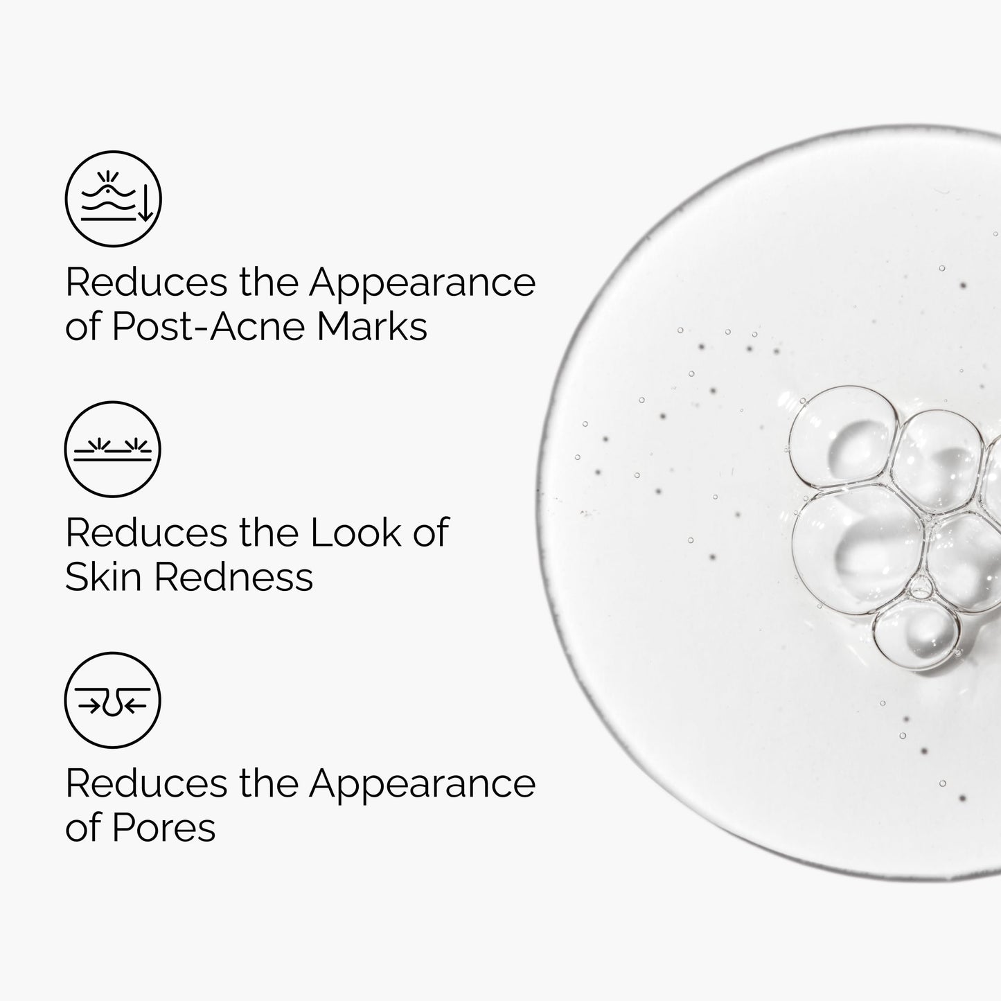 The Ordinary Aloe 2% + NAG 2% Solution, Soothes Skin and Targets Post-Acne Marks, 1 Fl Oz Beauty and Personal Care The Ordinary