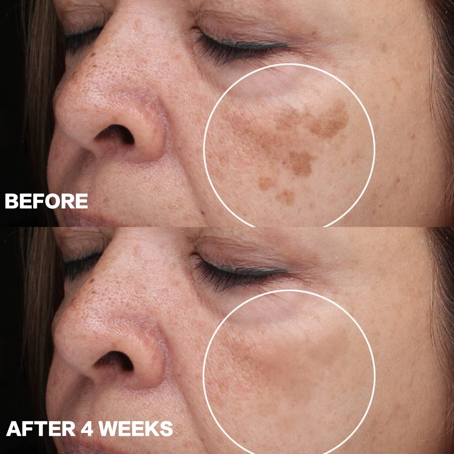 CITYGOO Dark Spot Remover for Face: Dark Spot Corrector Cream - Enriching Skin Care For All Skin Tones - Melasma Freckle Sun Spot Remover & Blemish