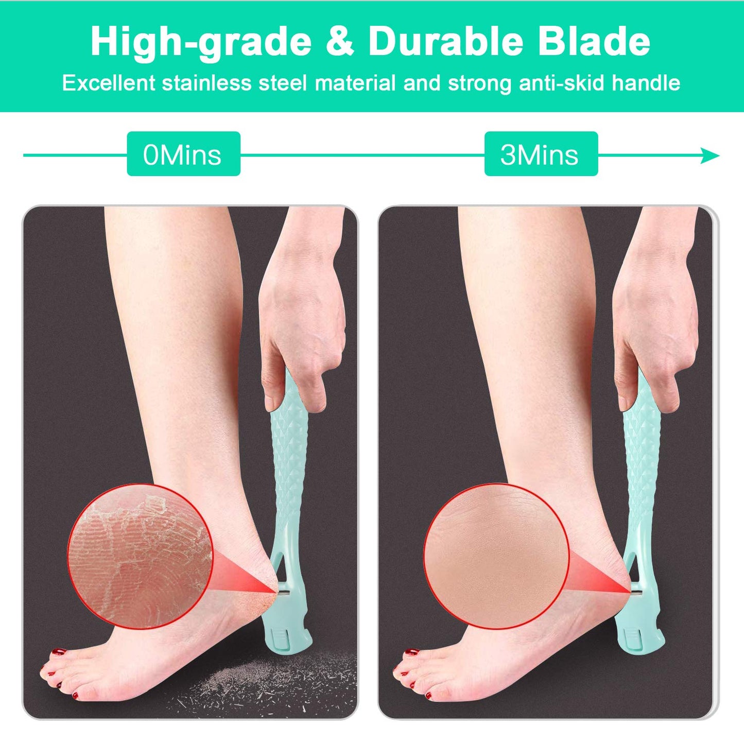 Foot Care Pedicure Callus Shaver Hard Skin Remover, Sichy Heel Scraper for Feet, 10 Replacement Slices 1 Stainless Steel Callus Shaver Foot Care Tools