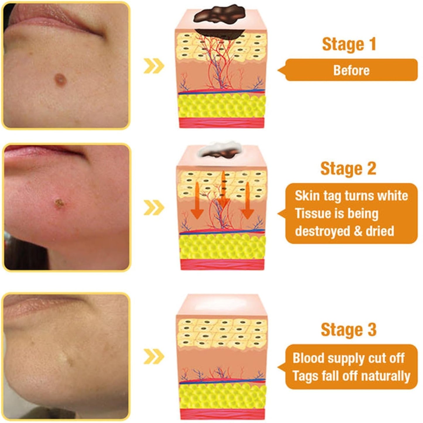 Bee Venom Skin Treatment Cream, 2024 New Bee Venom Repair Cream, Professional Bee Venom Cream-30g, Repair Maximum Strength for All Skin Types (1