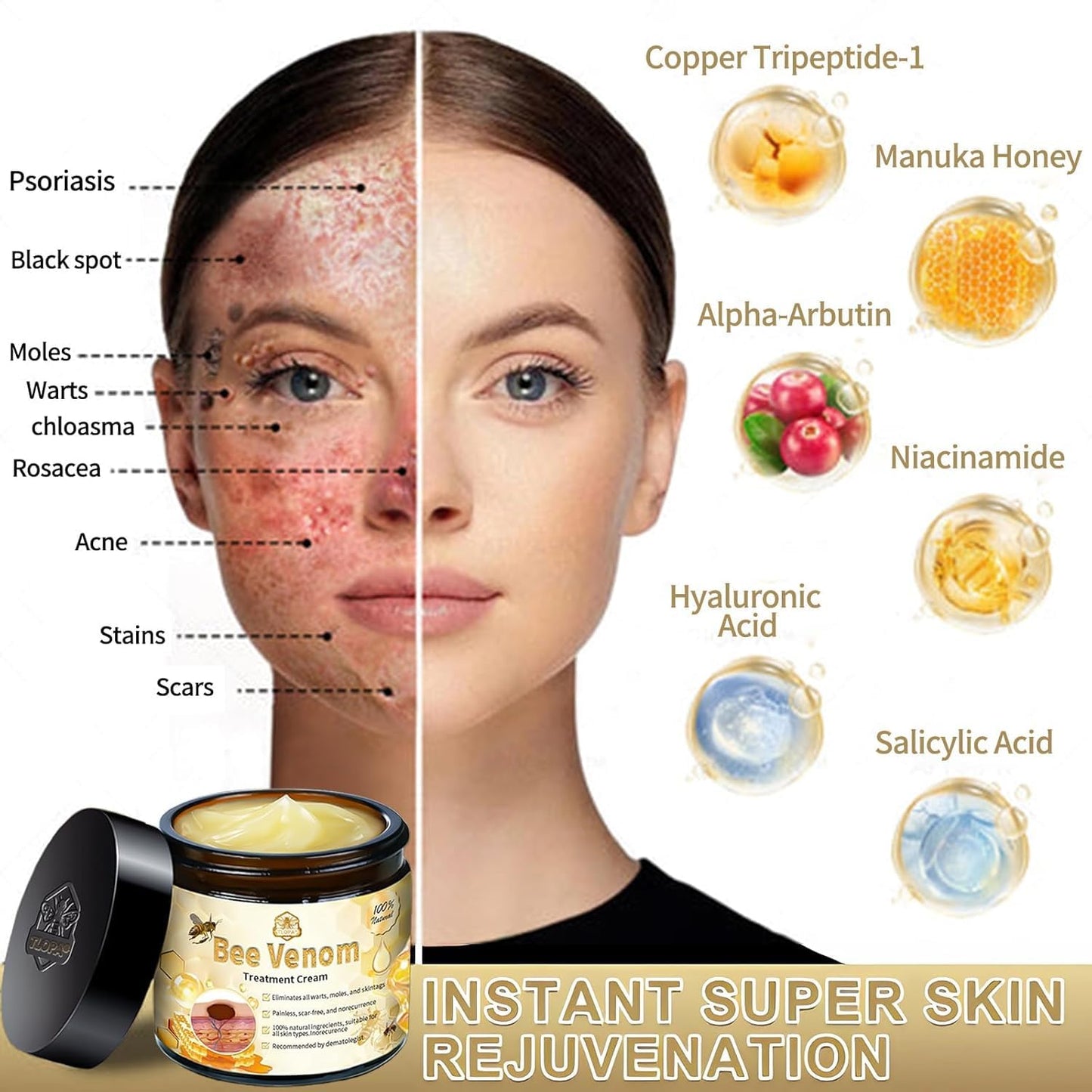 Bee Venom Skin Treatment Cream, 2024 New Bee Venom Repair Cream, Professional Bee Venom Cream-30g, Repair Maximum Strength for All Skin Types (1