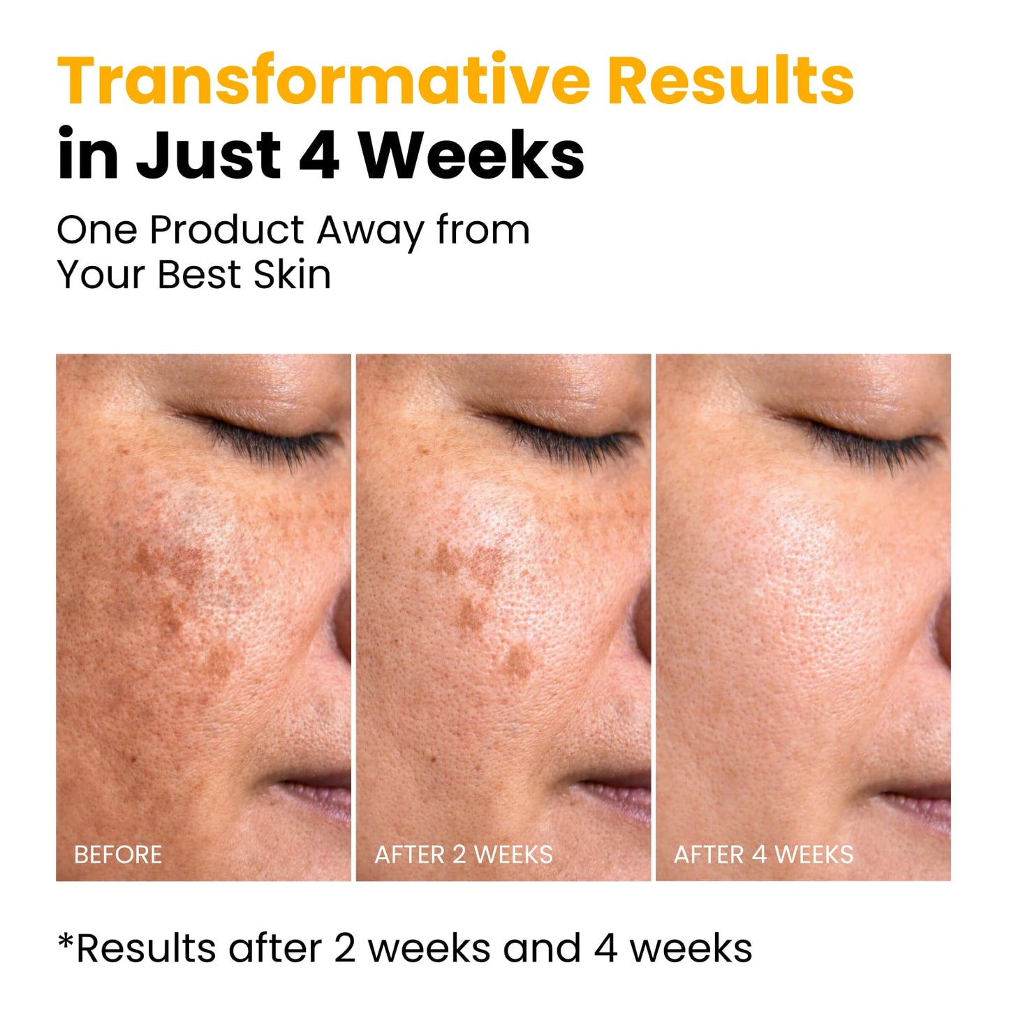 QUIA Turmeric + Kojic Acid Overnight Wrapping Mask - Hydration Mask for Glowing Skin - Evens Tone, Soothes Redness and Improves Skin Texture - Korean Beauty and Personal Care QUIA Beauty