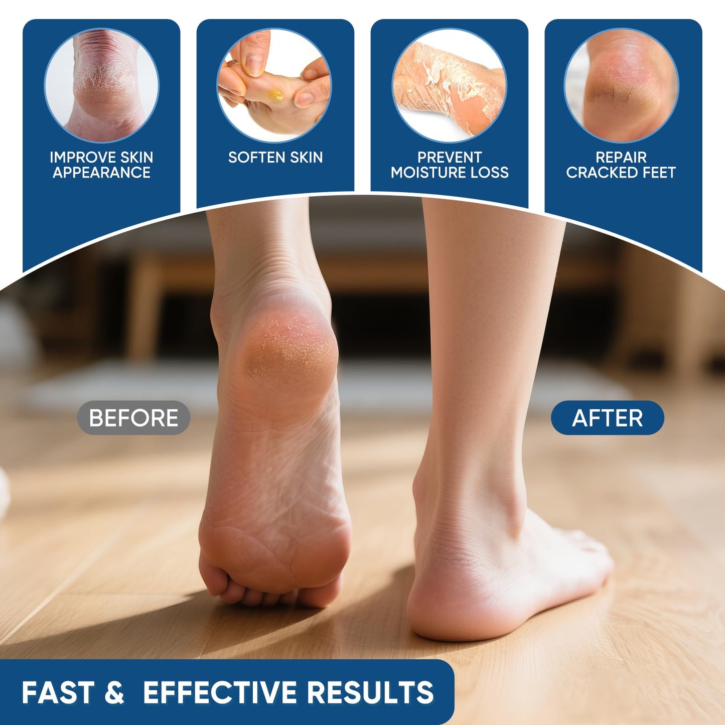 VREKEF Urea Cream 40 Percent with 2% Salicylic Acid, Urea Cream 40 Percent for Feet Maximum Strength, Foot & Hand Cream for Dry Cracked Heels, Callus Beauty and Personal Care VREKEF