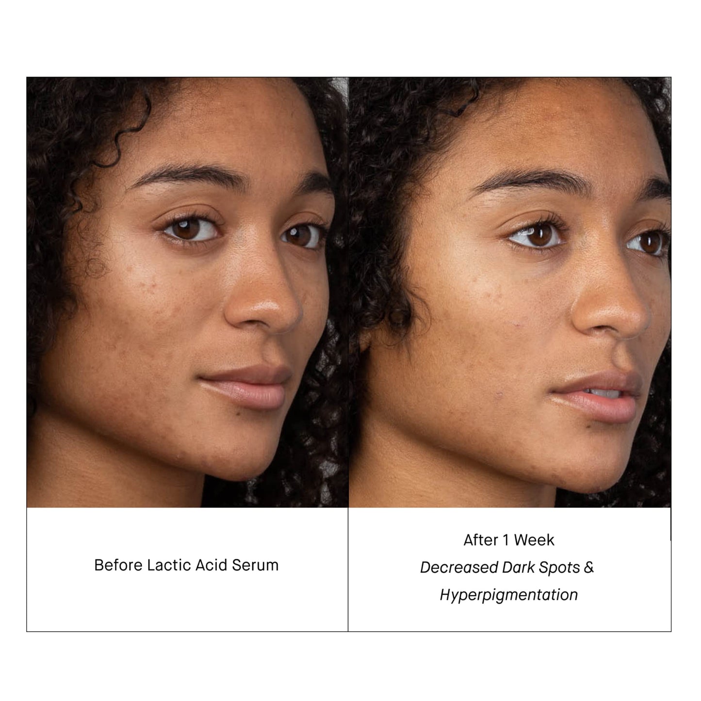 SHANI DARDEN SKIN CARE Lactic Acid Face Serum Travel Size, Active Night Serum to Help with the Look of Radiant and Smooth Skin, Gentle But Powerful