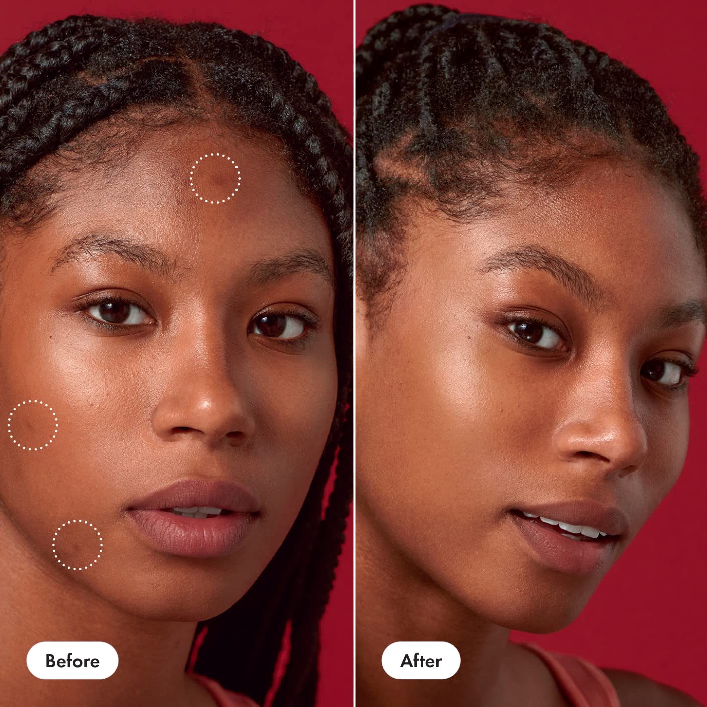 Hero Cosmetics Rescue Balm +Dark Spot Retouch 0.5oz – Post-Blemish Recovery Cream, Calms, Nourishes & Corrects Discoloration, Derm-Tested