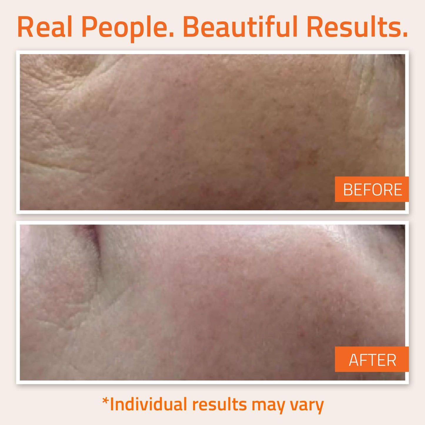 YEOUTH Vitamin C Face Serum with Hyaluronic Acid, Hydrating Vitamin C Serum for Face, Facial Serums Targets the Appearance of Dull Spots 2oz