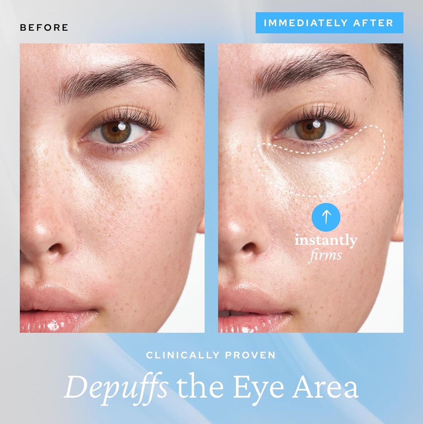 belif Aqua Bomb Cooling Eye Gel - Caffeine & Hyaluronic Acid for Puffiness & Hydration, Niacinamide & Vitamin C for Dark Circles, Adenosine & Collagen Beauty and Personal Care belif