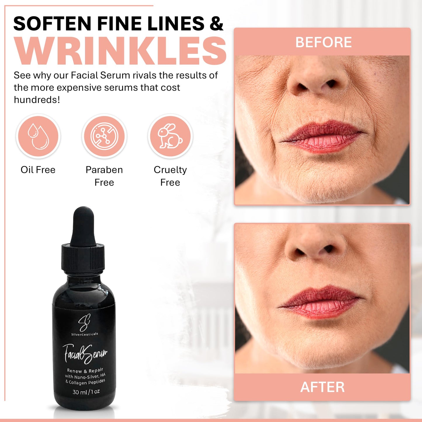 Facial Serum - Fight Blemishes - Acne Pimples & Breakouts - Soften Fine Lines & Wrinkles - Hydrate & Repair Damaged Skin - Clear Complexion