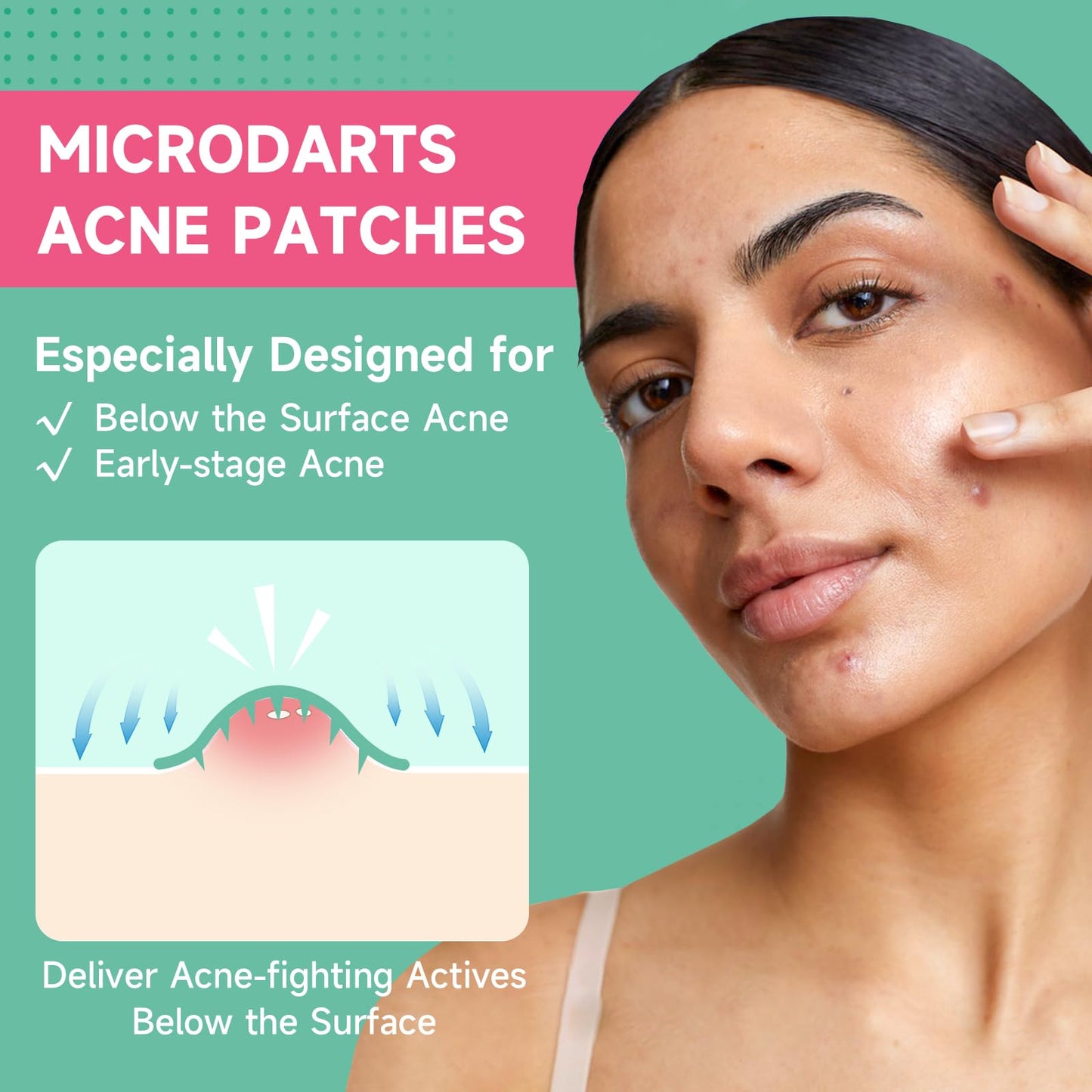 144-Count Microdart Acne Patches, Hydrocolloid Pimple Patches with Salicylic Acid & Madecossoside, Microdart Zit Patches for Deep Blemishes & Early Beauty and Personal Care TEAWOO