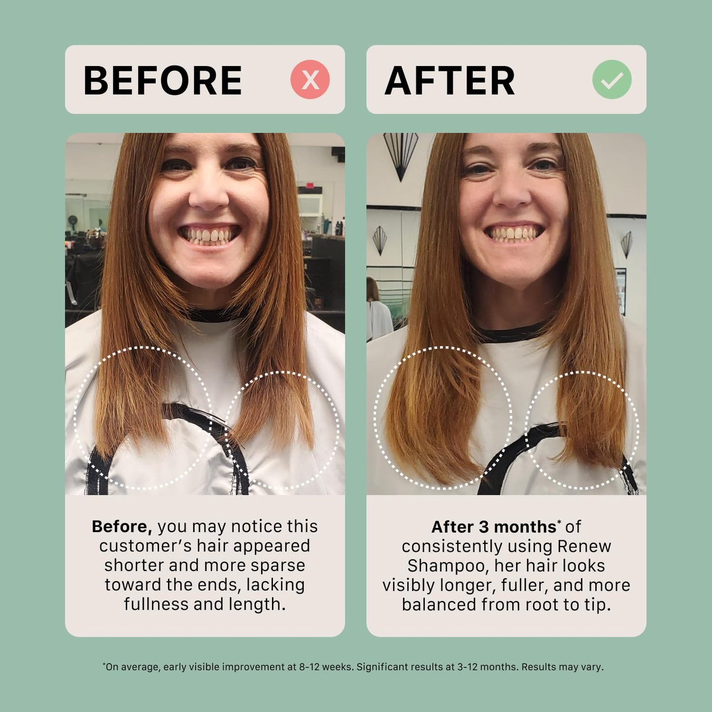 ACTIIV Renew Healing Shampoo Treatment | Improved Hair's Appearance, Promotes Scalp Health, Heals Damaged & Over-Processed Hair, Plant-Based