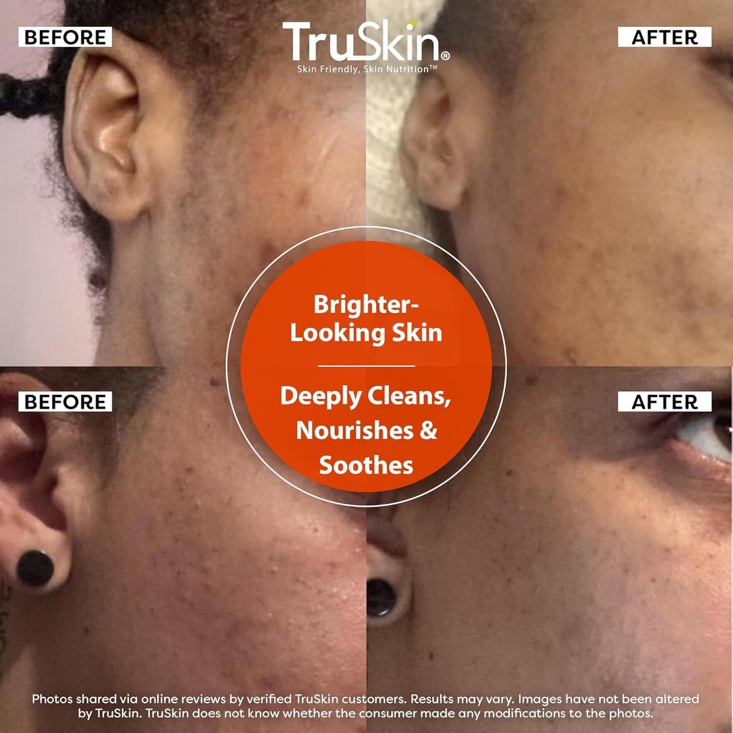TruSkin Vitamin C Cleanser for Face - Brightening Face Wash with Vitamins C & E, Rosehip Oil, Aloe Vera and MSM - Deep Clean and Refresh for Radiant