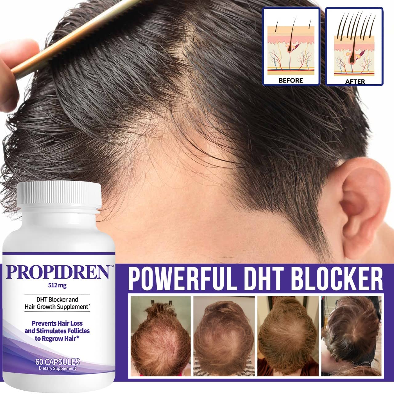 Propidren DHT Blocker & Hair Growth Pills To Stop Hair Loss and Regrow Hair Beauty and Personal Care Pronexa