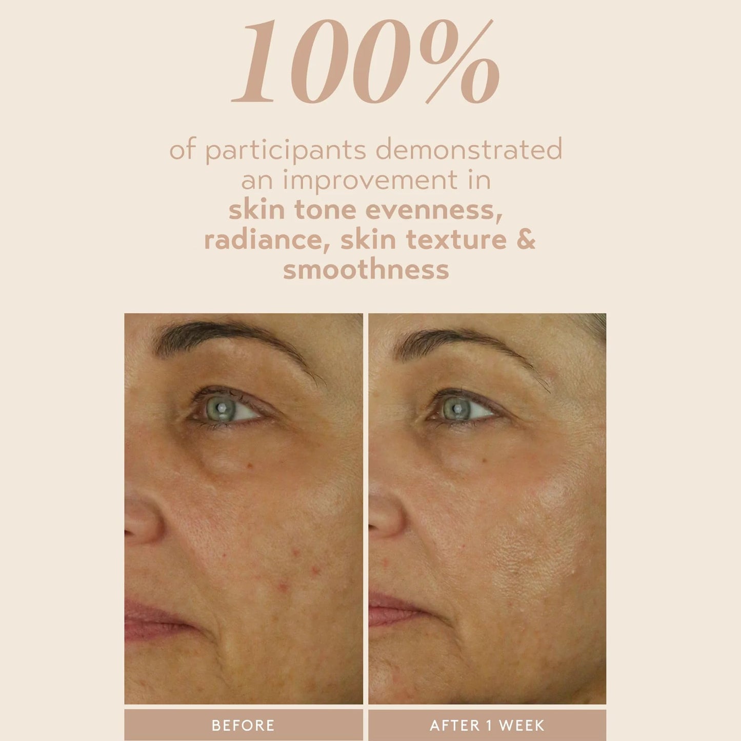 SHANI DARDEN SKIN CARE Retinol Reform with 1% Encapsulated Retinol Serum for Face & Neck, Gentle Slow-Release Retinol Face Serum with Tripeptide Beauty & Personal Care SHANI DARDEN