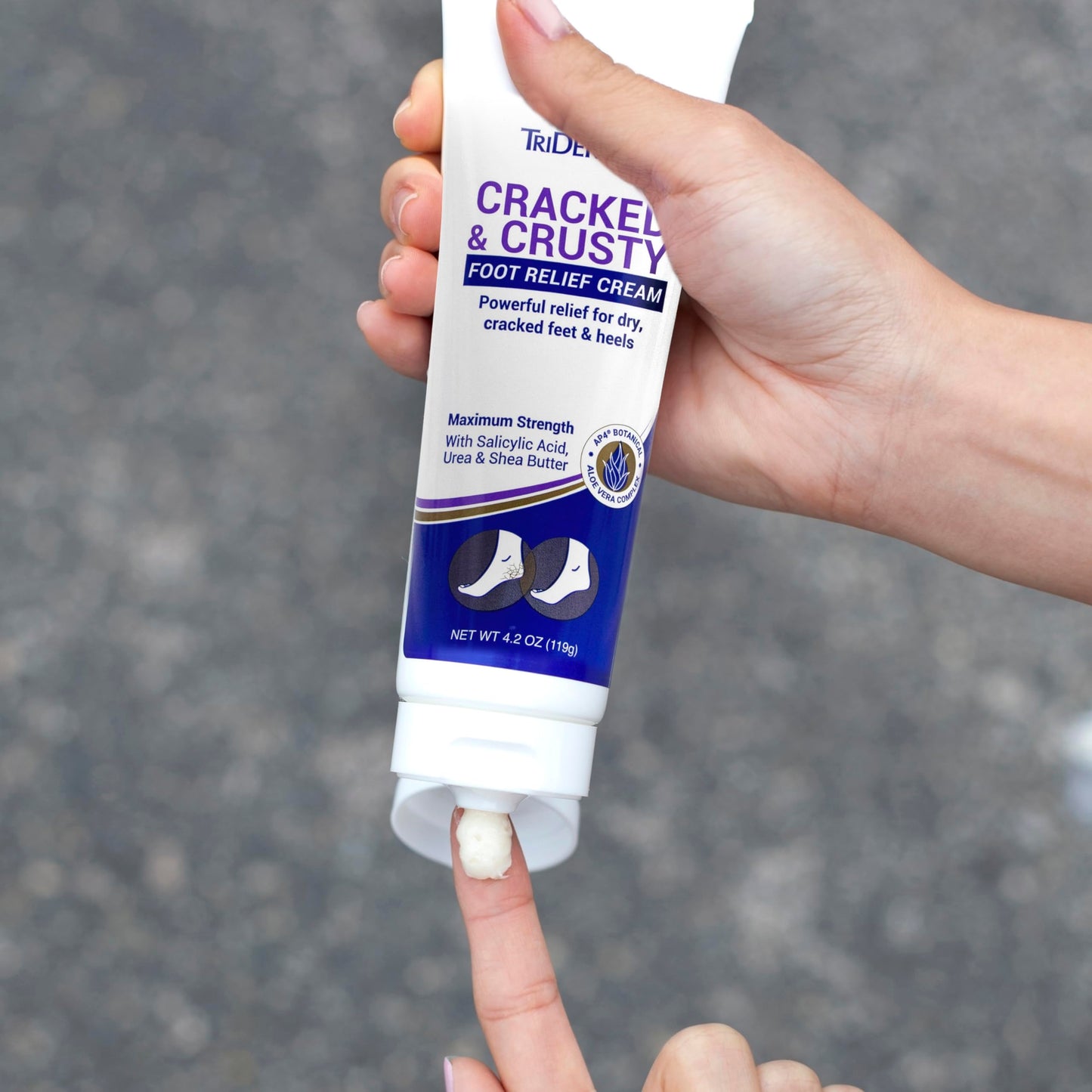 TriDerma Cracked & Crusty™ Healthy Foot Cream Moisturizes, Softens and Heals Dry Feet, Cracked Heels and Dry Elbows with Salicylic Acid, Urea, Shea