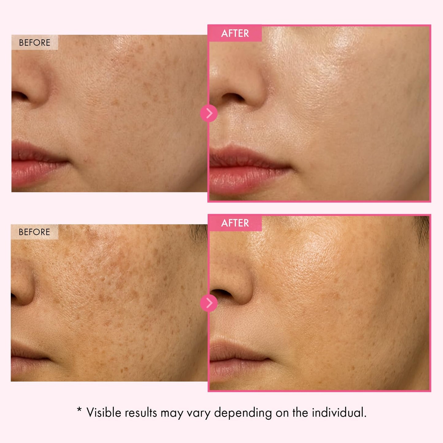TOSOWOONG Arbutin 7% Glutathione Cream, 70,000ppm Arbutin + 5,001ppm Glutathione, Niacinamide, Dark Spots, Freckle, Blemishes, Pigmentation, Dullness Beauty and Personal Care TOSOWOONG