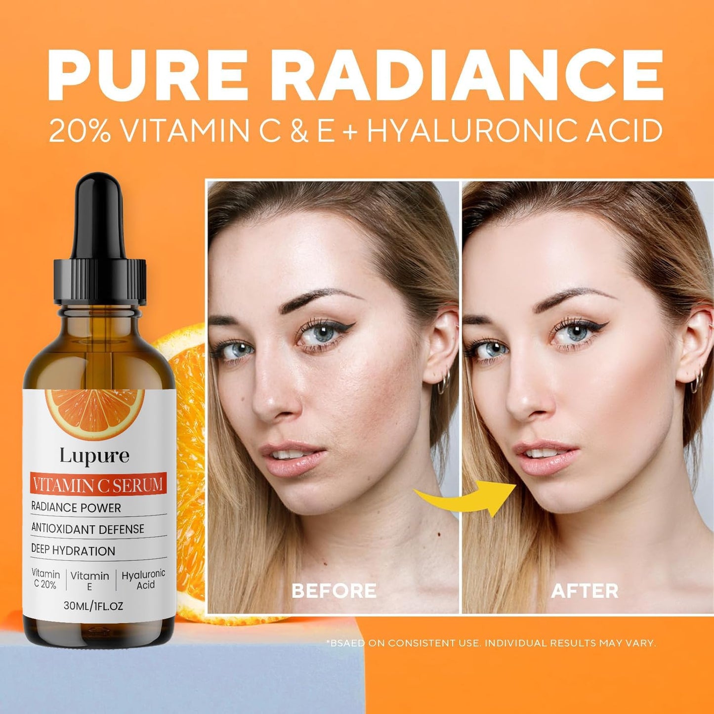 Lupure Professional Vitamin C Face Serum 20%, Anti Aging Facial Super Vit C Serum with Ascorbic Acid Hyaluronic Acid & Vitamin E for Dark Spots, Skin