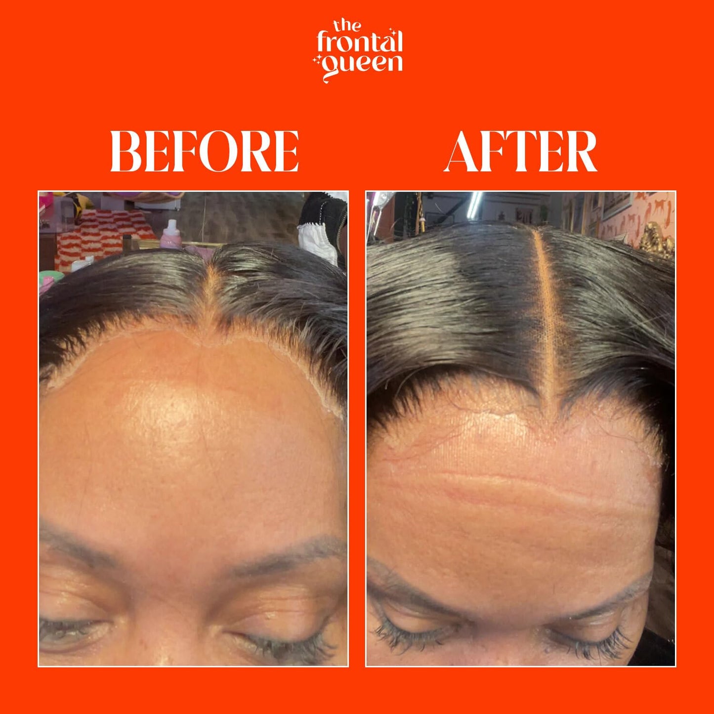The Frontal Queen Lace Melting Spray, Ashy Lace Melting Spray for Lace Wigs, Lace Bond Spray, Extra Hold Lace Melting Spray Adhesive Wig, No Residue