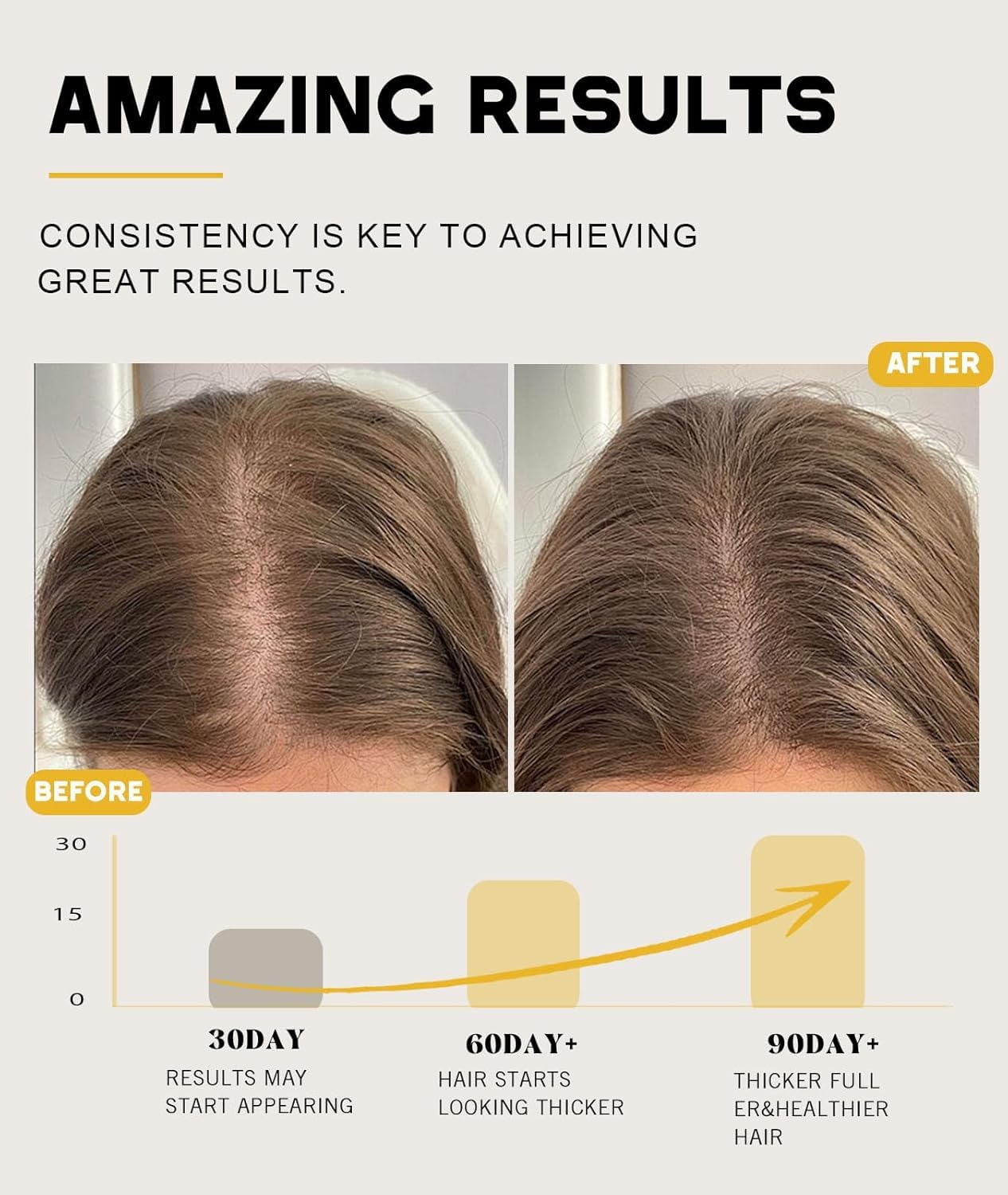 Batana Oil for Hair Growth, 100% Natural Pure Batana Oil Paste from Dr. Sebi Honduras, Prevents Hair Loss, Enhances Thickness, Organic Raw Scalp Mask Beauty and Personal Care Qytin
