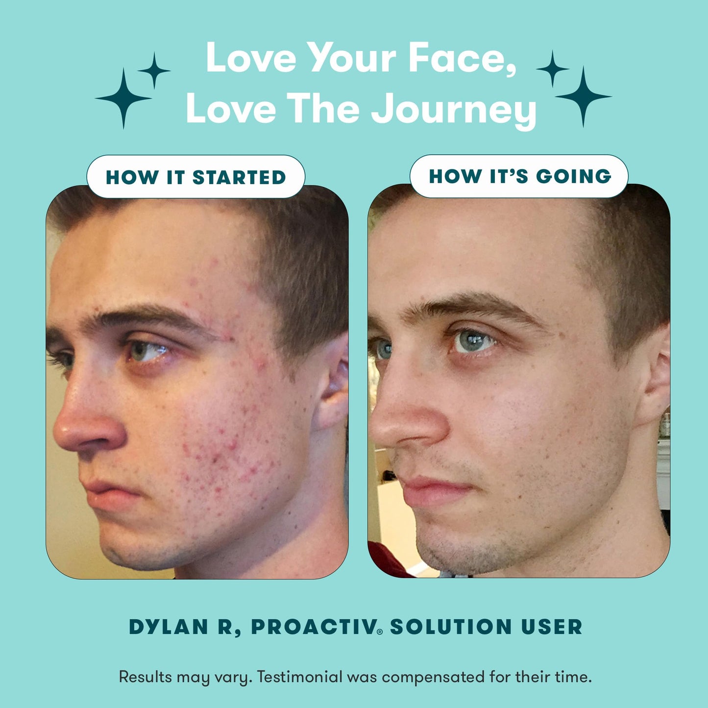 Proactiv 3 Step Acne Treatment System