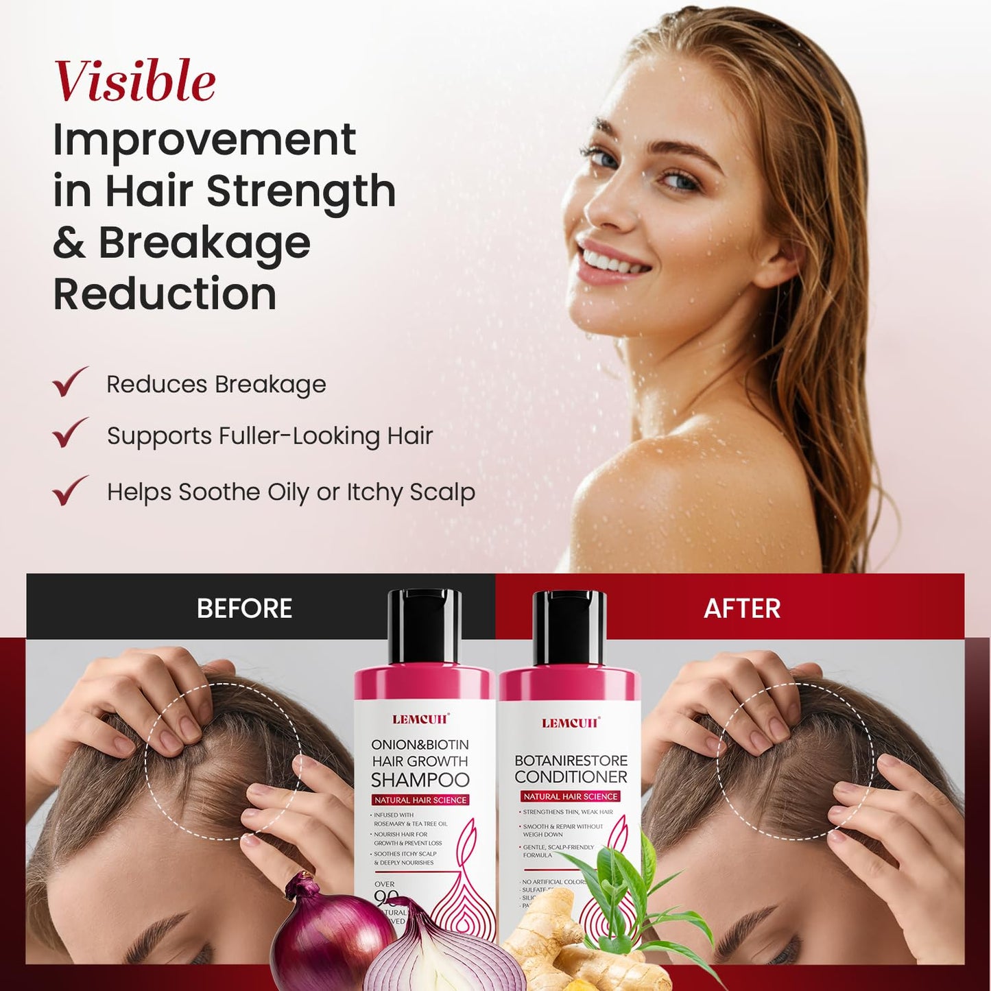 Onion Shampoo and Conditioner For Hair Growth - Onion Hydrosol Shampoo Duo With Biotin, Rosemary For Thinning and Healthier Thicker hair - Paraben