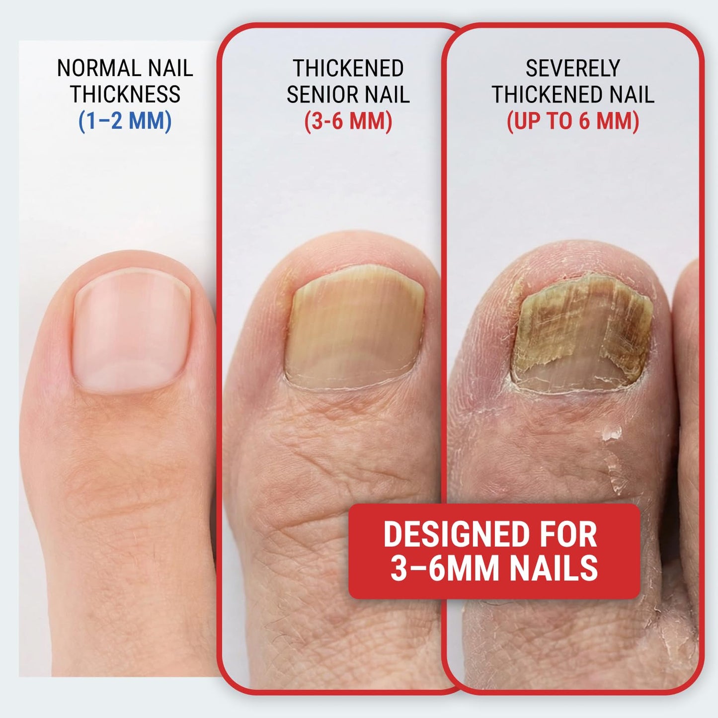 Toenail Clippers for Thick Toenails - KLIPP 15 mm Wide Jaw Thick Fingernail and Toenail Cutter with Curved Stainless-Steel Blades for Seniors (Angled Beauty and Personal Care KLIPP