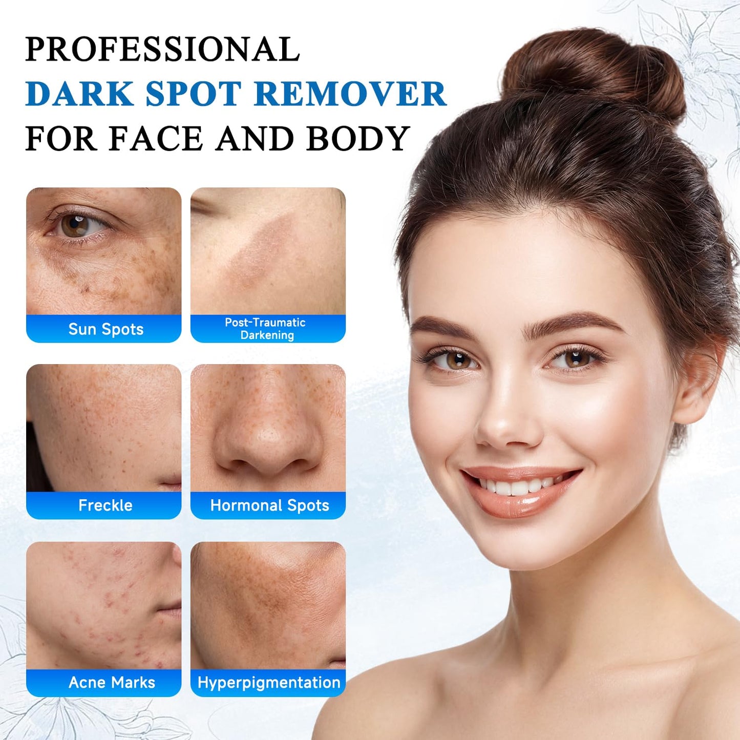 VBBV Dark Spot Remover for Face and Body, Dark Spot Corrector, Sun Spot Freckles Hyperpigmentation Treatment, Advanced Dark Spot Remover Cream