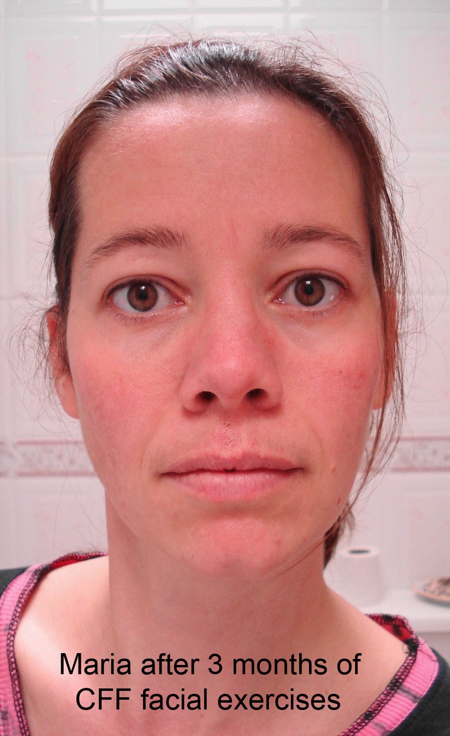 Facial Exercises by Carolyn's Facial Fitness - Value Pack with DVD
