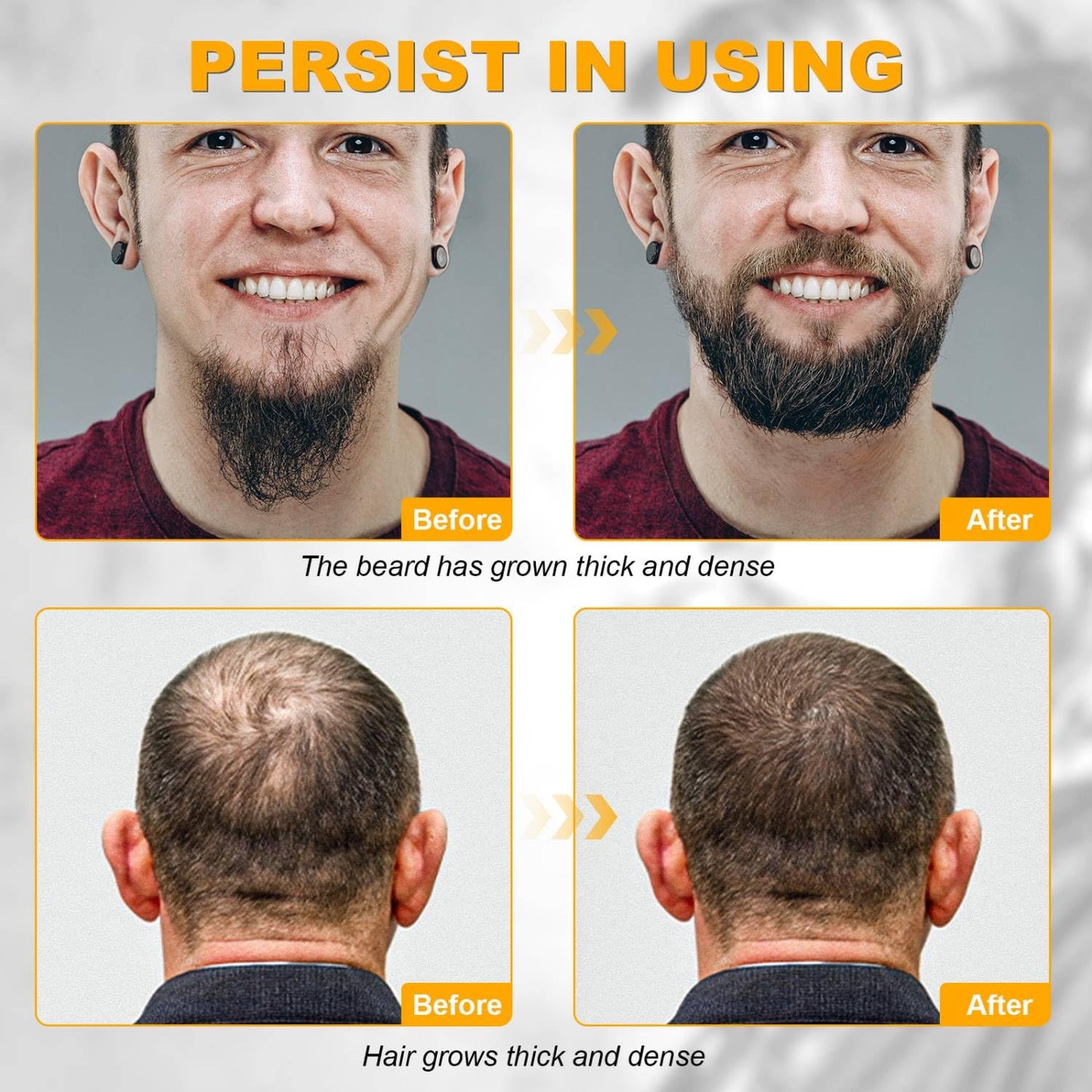Beard Growth Kit - Beard Kit for Men, Beard Growth Oil (2oz), Beard Balm, Beard Comb, Massager for Spot/Patchy Beard - Christmas, Anniversary