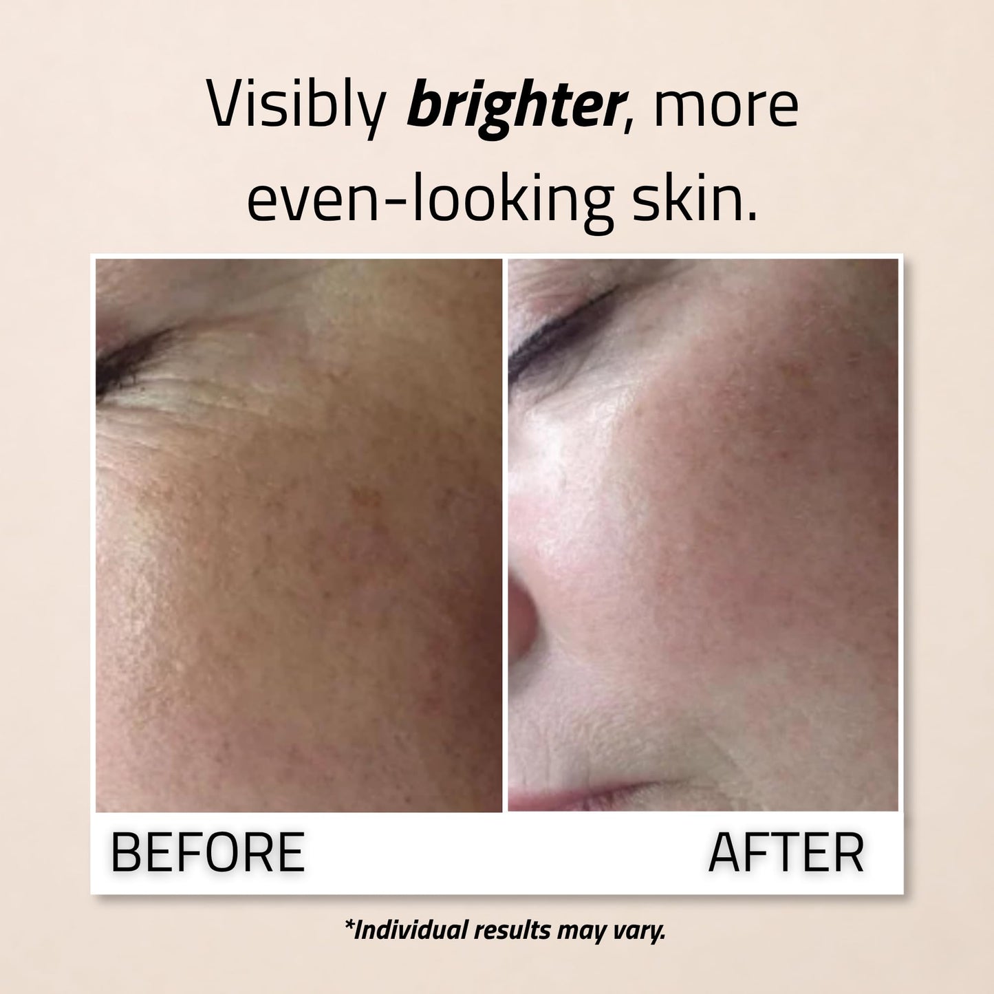 YEOUTH Vitamin C Serum for Face with Hyaluronic Acid and Vitamin E, Brightening Face Serum Targets the Appearance of Fine Lines and Uneven Skin Tone