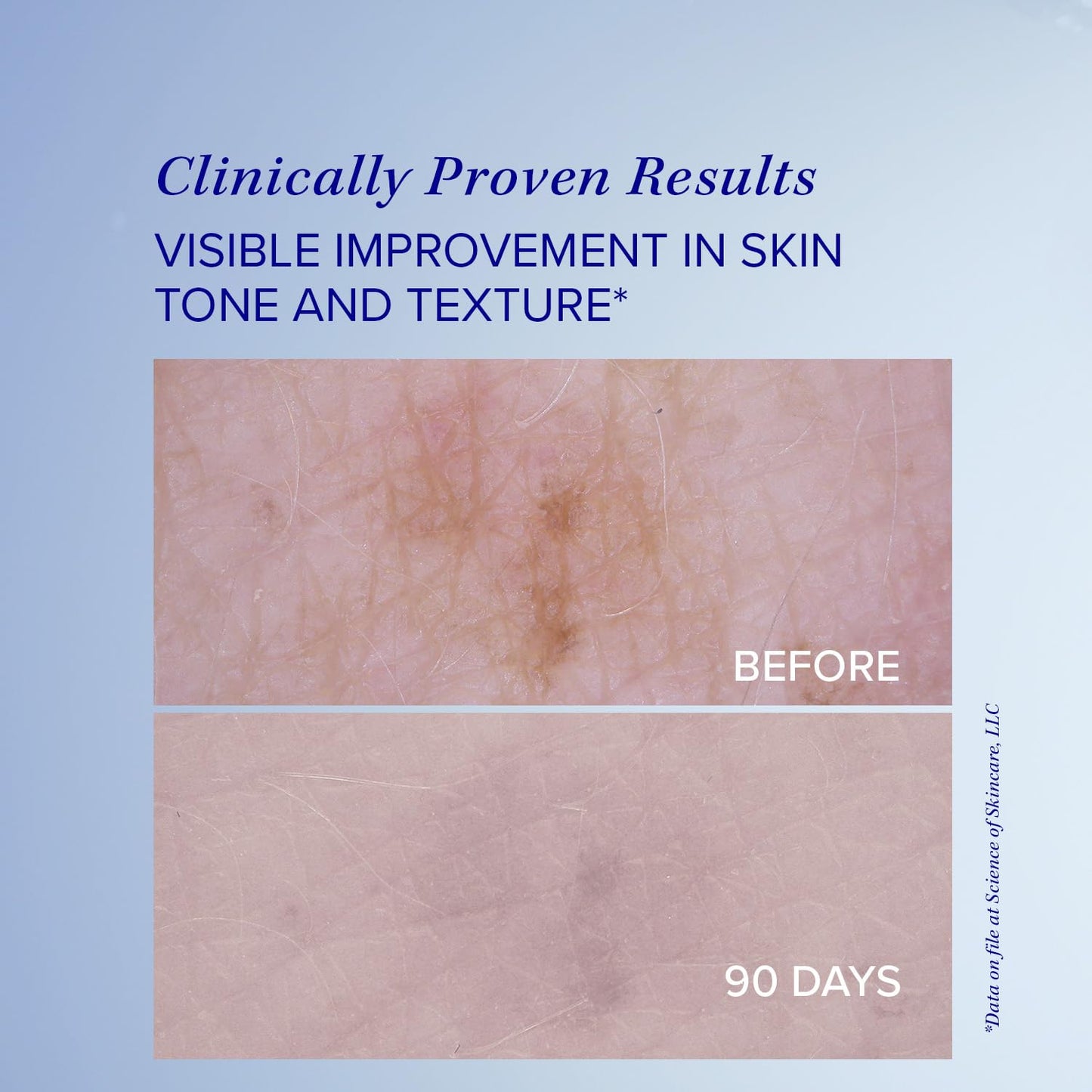 iS Clinical Brightening Serum 0.5 Fl Oz