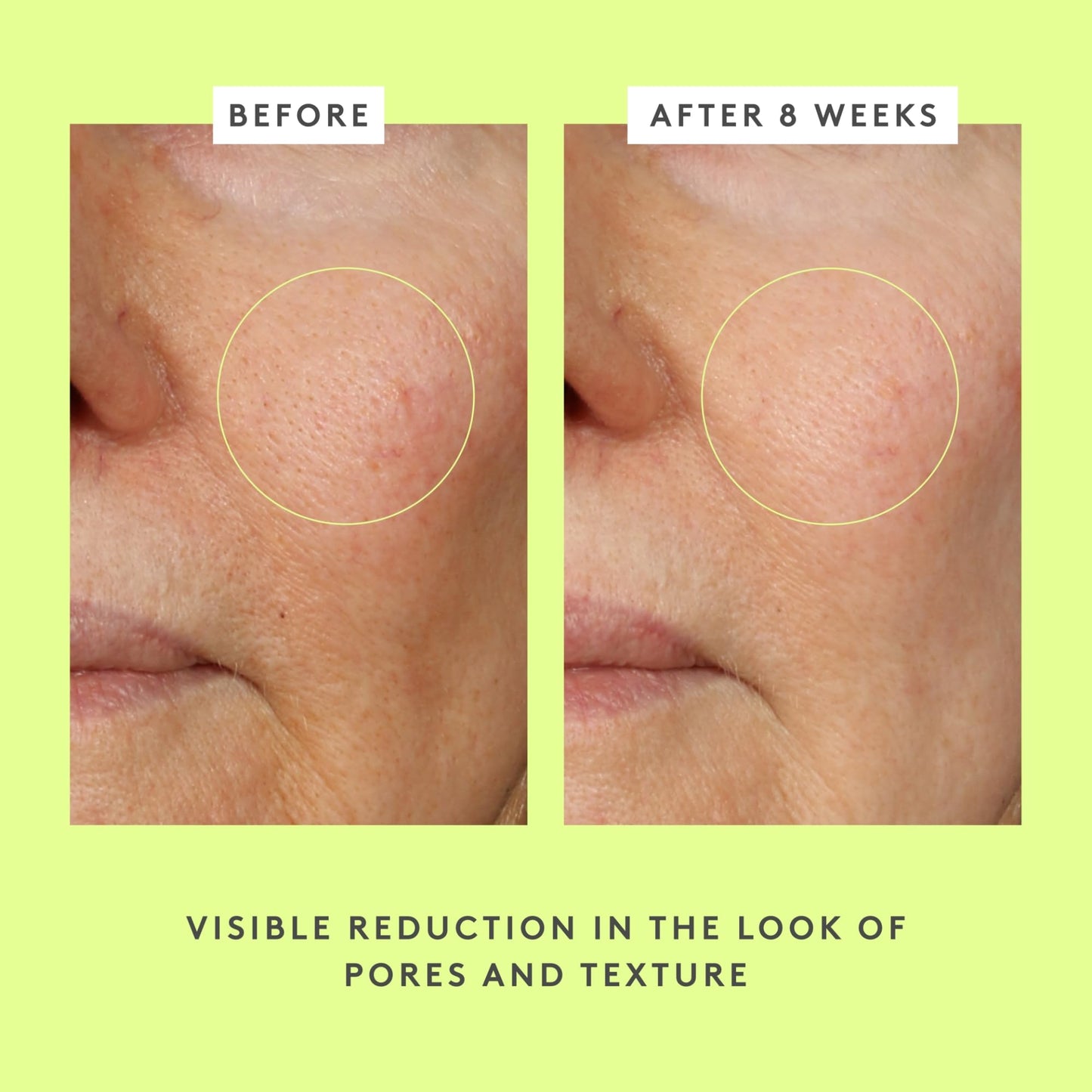 Drunk Elephant T.L.C. Framboos Glycolic Serum - 30 ml/1 fl oz - Exfoliating AHA Serum - Clean Clinical Skincare - Cruelty-Free - Dermatologist-Tested