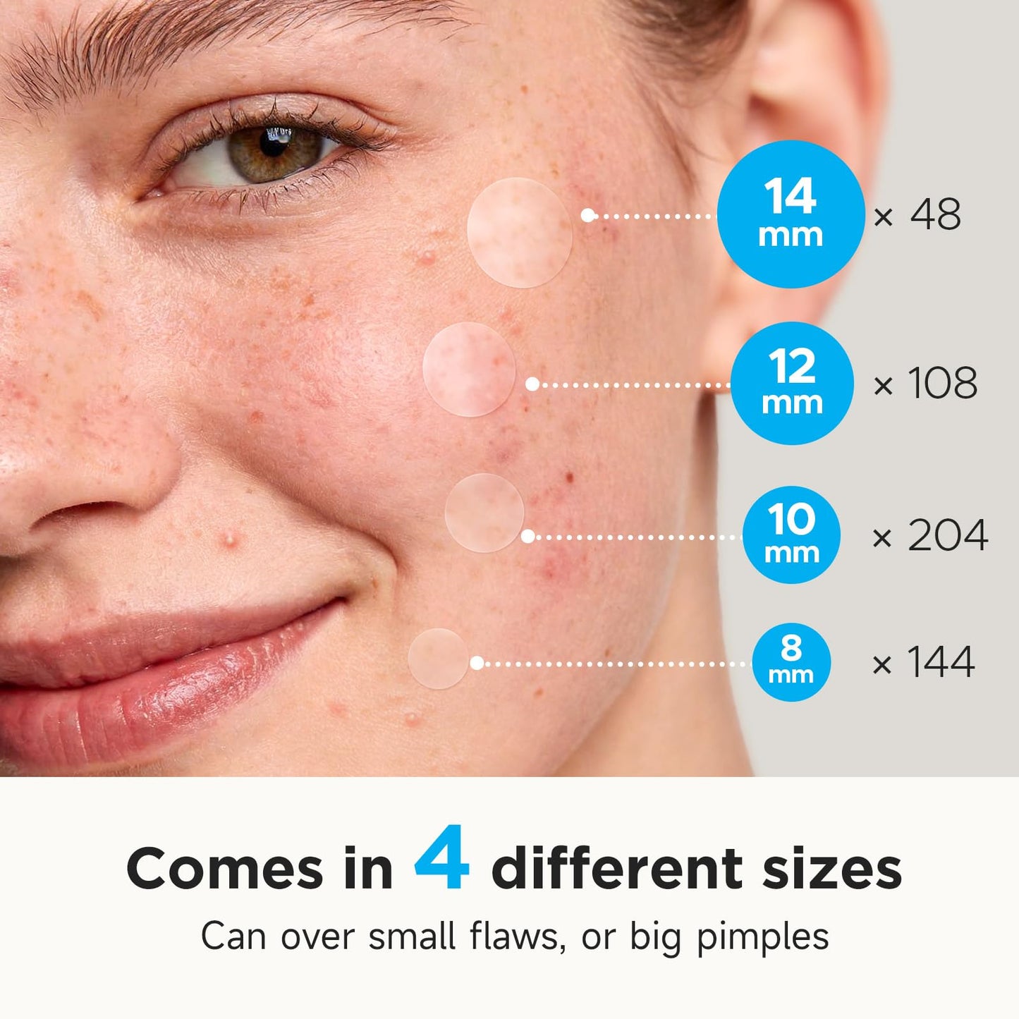Glowpatch Pimple Patches for Face (504 Count), FSA Eligible Acne Patch Bulk, Zit Stickers 4 Sizes, Hydrocolloid Spot Stickers, Clear Acne Dots Beauty and Personal Care Glowpatch