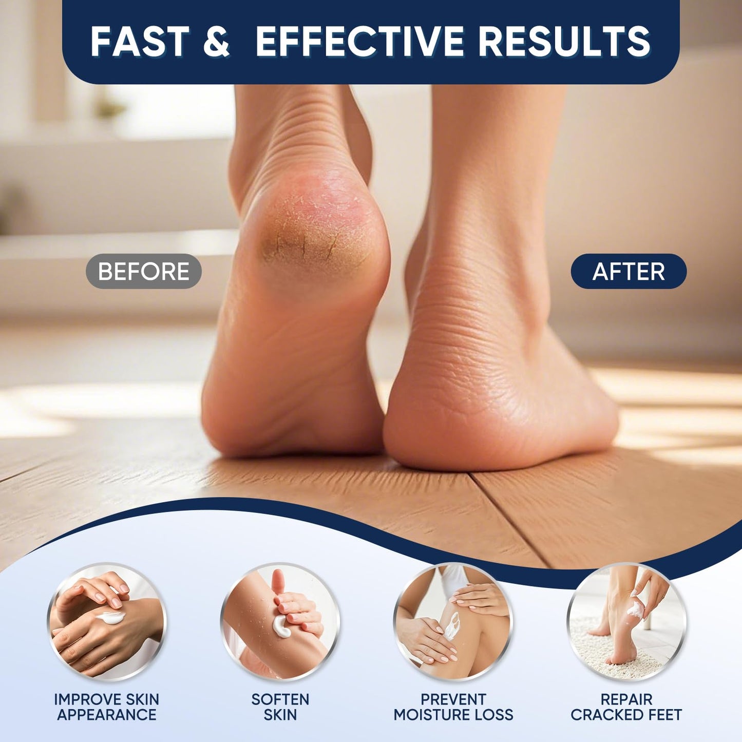 VREKEF Urea Cream 60% with 2% Salicylic Acid, Urea Cream 60 Percent for Feet Maximum Strength, Foot Cream & Callus Remover for Dry Cracked Heels Beauty and Personal Care VREKEF