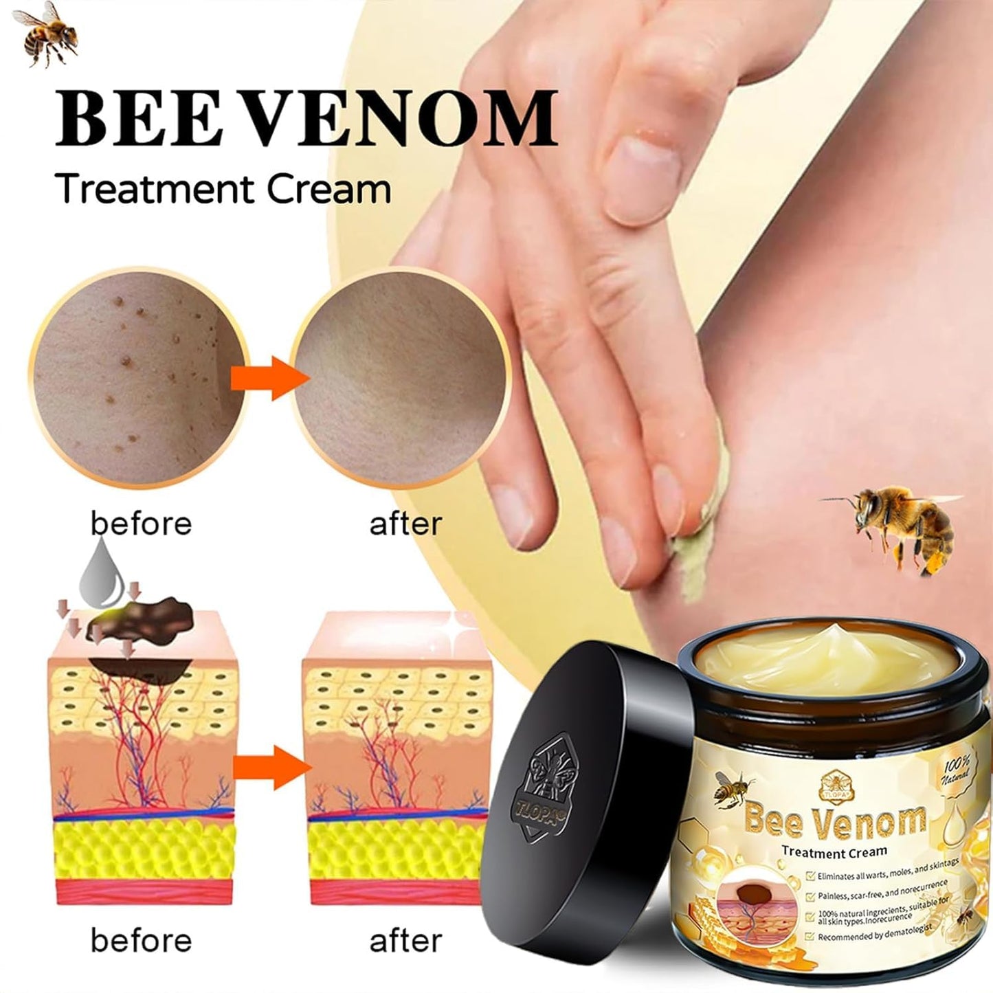 Bee Venom Skin Treatment Cream, 2024 New Bee Venom Repair Cream, Professional Bee Venom Cream-30g, Repair Maximum Strength for All Skin Types (1