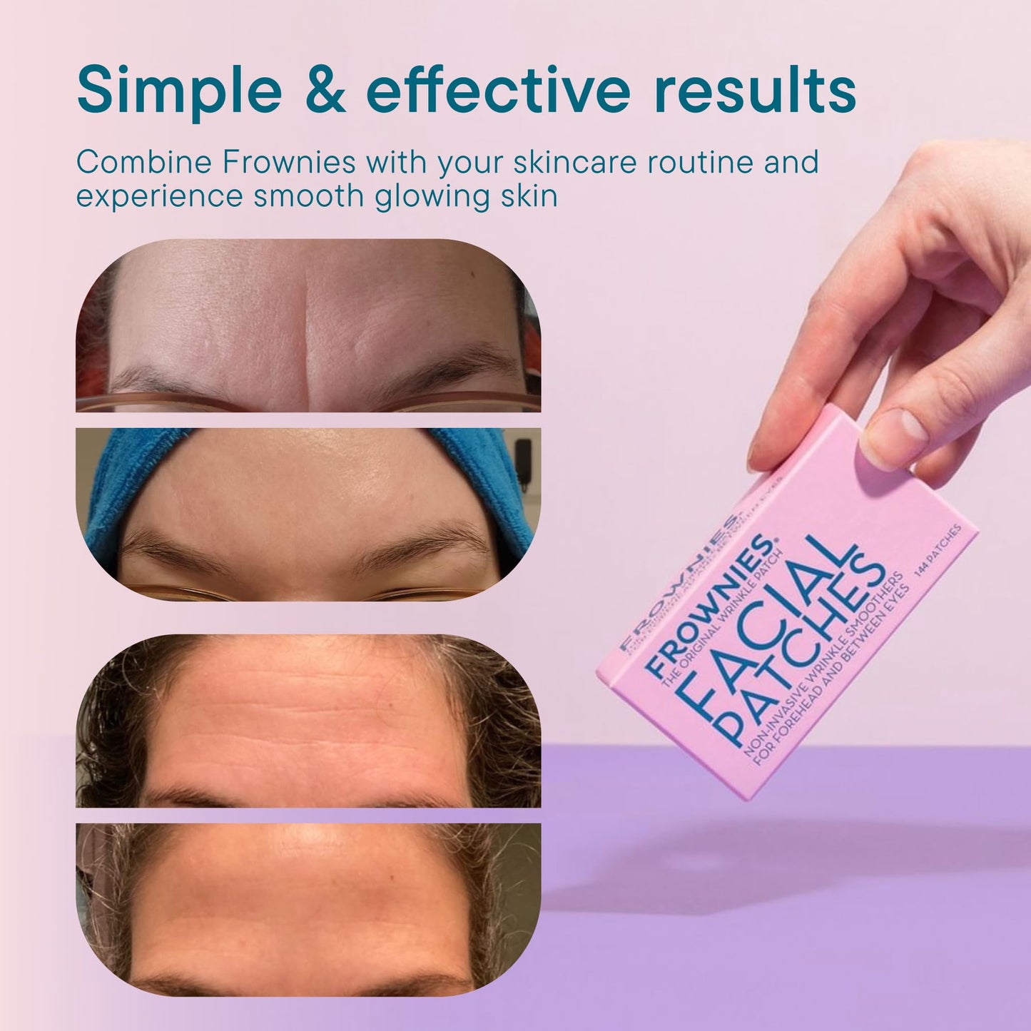 Frownies Forehead and Between the Eyes Wrinkle Patches - Hypoallergenic Facial Patches to Smooth & Soften Forehead Wrinkles & Eleven Lines - Beauty and Personal Care Frownies