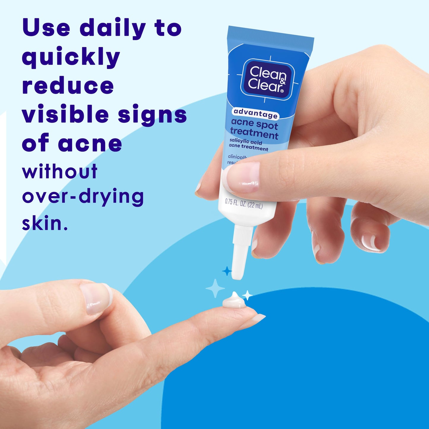 Clean and Clear Advantage Acne Spot Treatment Gel Cream with 2% Salicylic Acid & Witch Hazel, Acne Pimple Medication for Blemish & Blackhead Removal