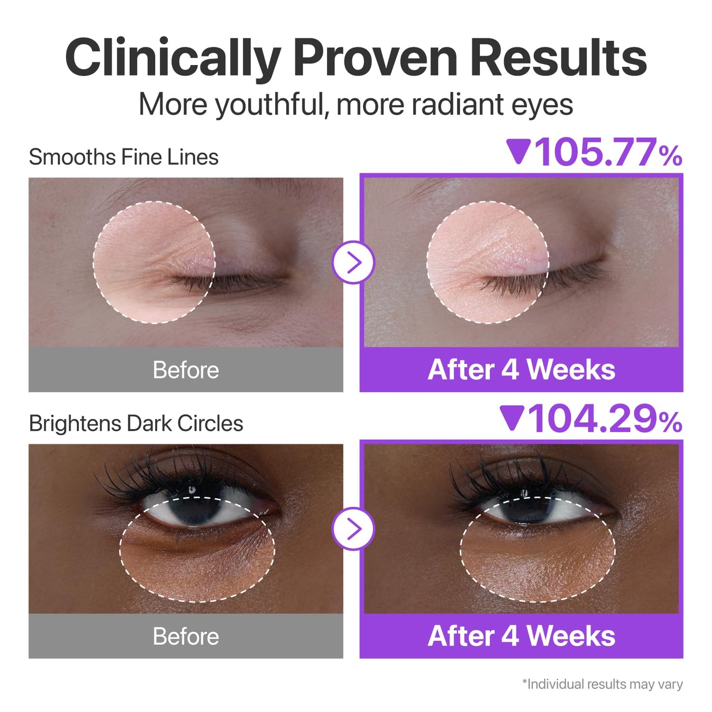 numbuzin No.9 NAD+ Retinol Eye Cream for Dark Circles, Puffiness, Crow's Feet with 50 Peptides, 4% Niacinamide & Ceramide, Reduces Wrinkles & Fine Beauty and Personal Care numbuzin