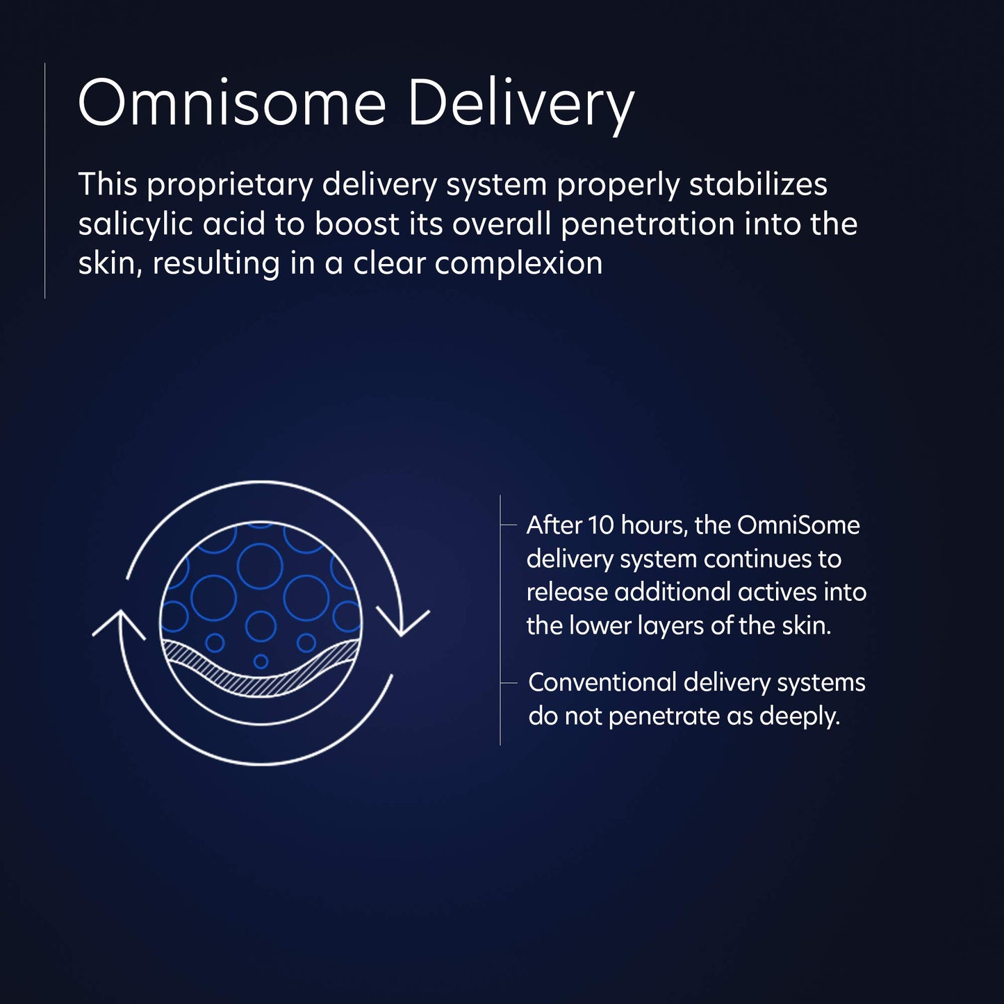 PCA SKIN Retinol Treatment for Sensitive Skin - Anti Aging Face Serum to Gently Reduce Redness & Minimize Fine Lines & Wrinkles - Contains Vitamin