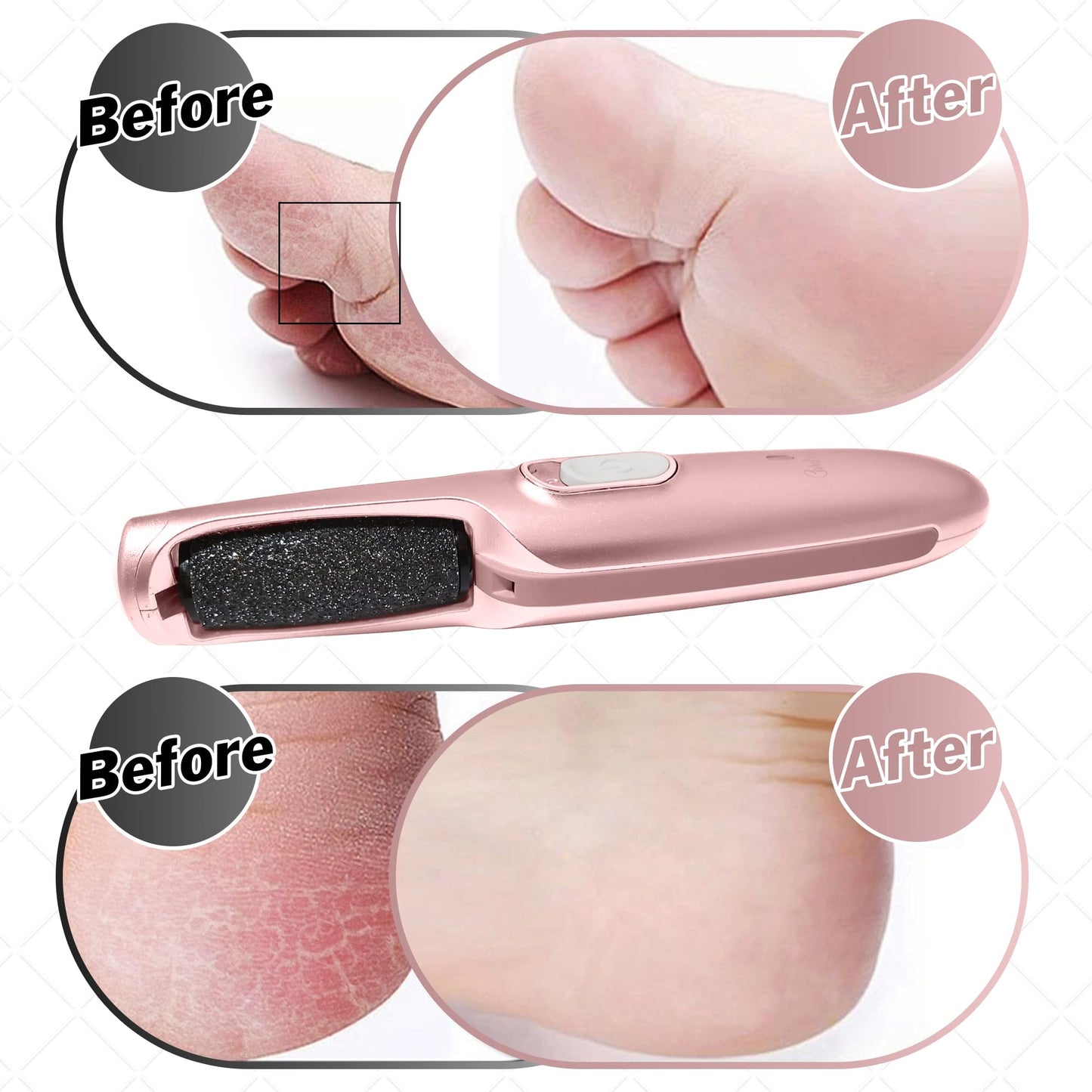 Powerful Electric Callus Remover Wand - Rechargeable Foot File, Grinder & Scrubber - Removes Dead, Hard Skin & Calluses - Best Pedicure Tool for Soft