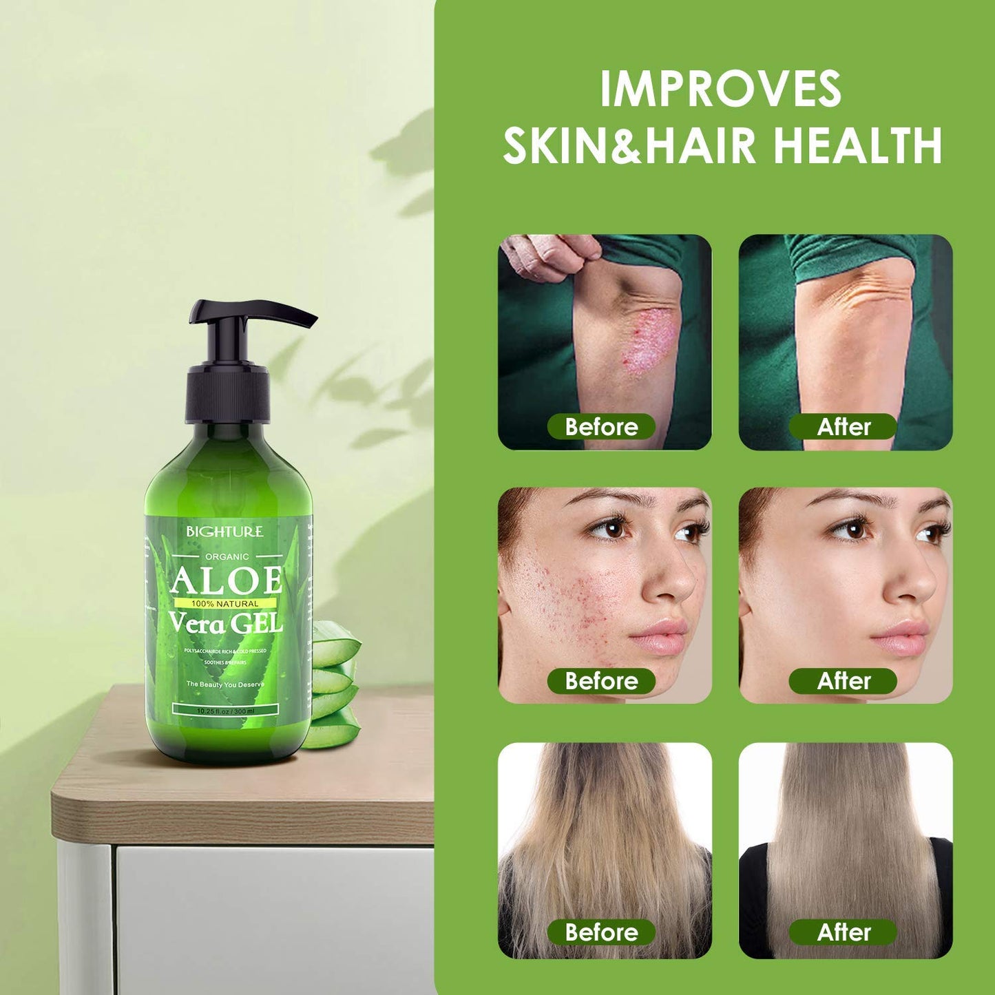 BIGHTURE Aloe Vera Gel, 100% Aloe Vera from Freshly Cut Aloe Leaves, Skin Care for Deeply & Rapidly Soothing, Firming, After Shave, Sunburn Relieve