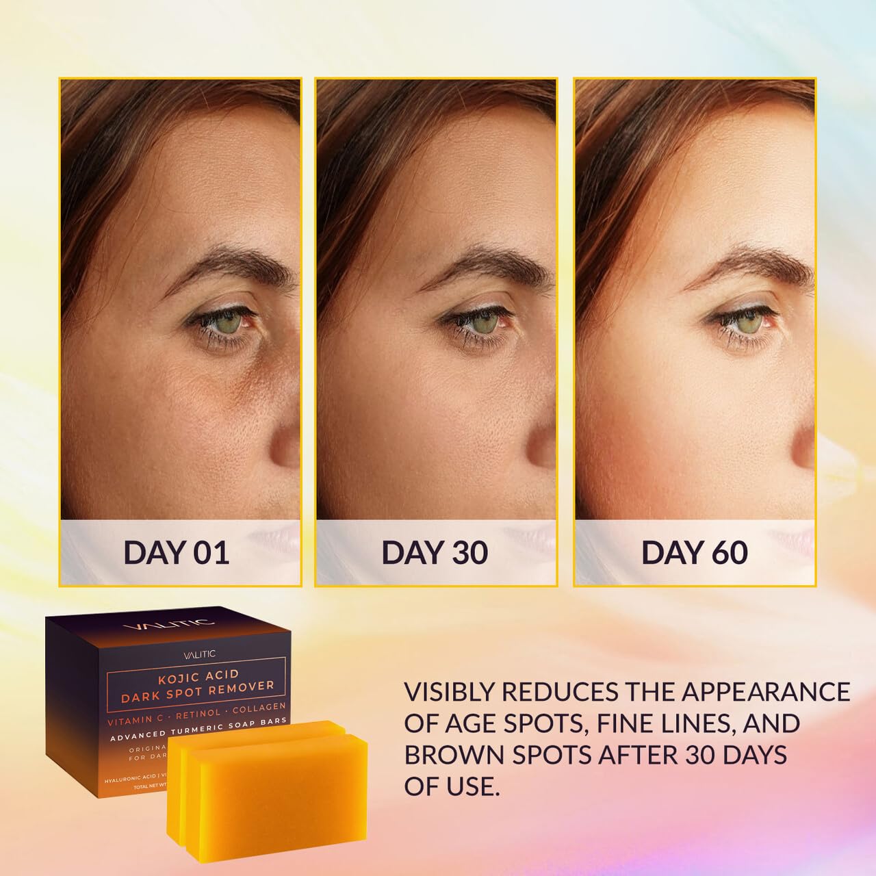 VALITIC Kojic Acid Dark Spot Remover Soap Bars with Vitamin C, Retinol, Collagen, Turmeric - Original Japanese Complex Infused with Hyaluronic Acid