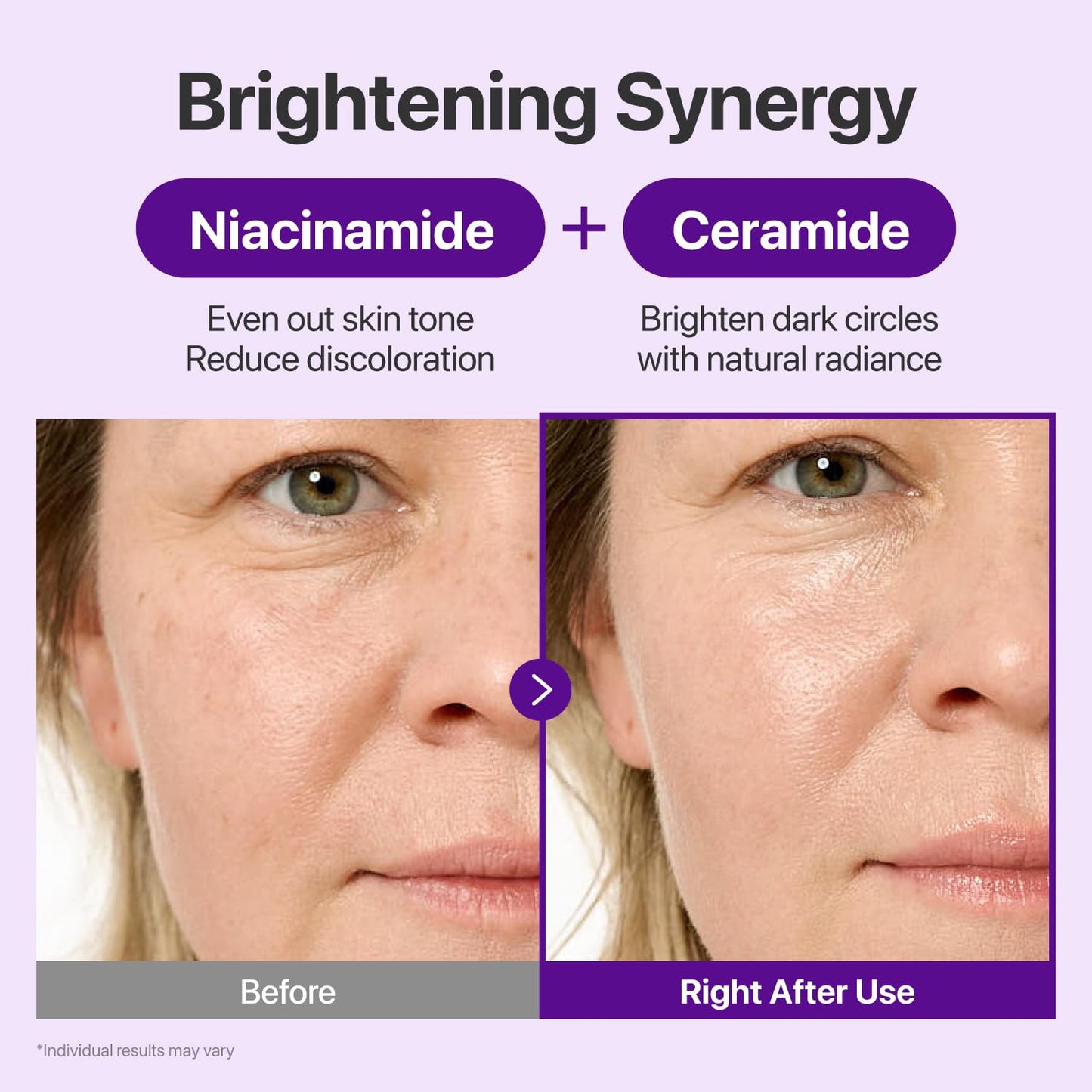 numbuzin No.9 NAD+ Retinal Eye Cream for Anti-Aging, Pore Minimizer, Wrinkles, Firmer Skin with Retinoid, Peptides & Niacinamide, Gentle Retinal Beauty and Personal Care numbuzin