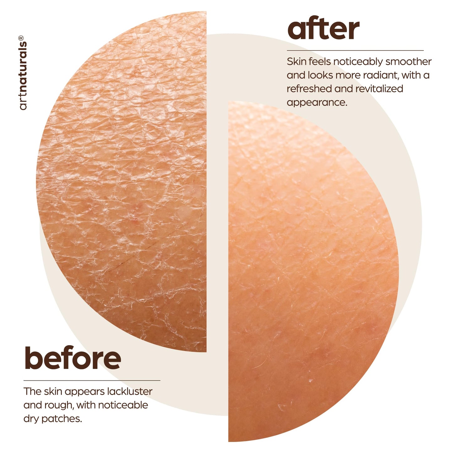artnaturals Natural Arabica Coffee Scrub- Body - Exfoliating and Rejuvenating Body Rub - For Skin care, Stretch Marks, Acne and Cellulite - 20 oz Beauty & Personal Care Artnaturals