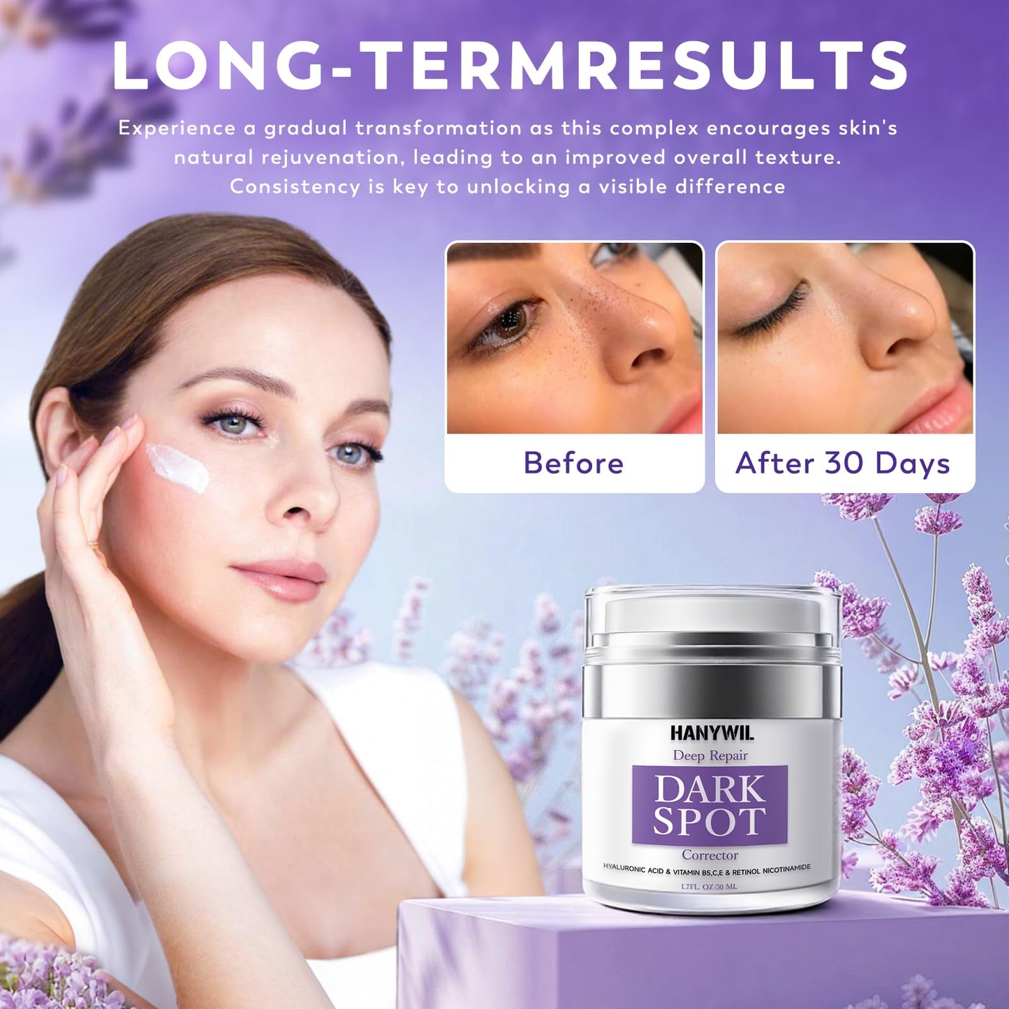 HANYWIL Dark Spot Remover for Face & Body, Remedy for Dark Spots with Natural Ingredients, Dark Spot Corrector Cream and Serum for Skin Care, Treats