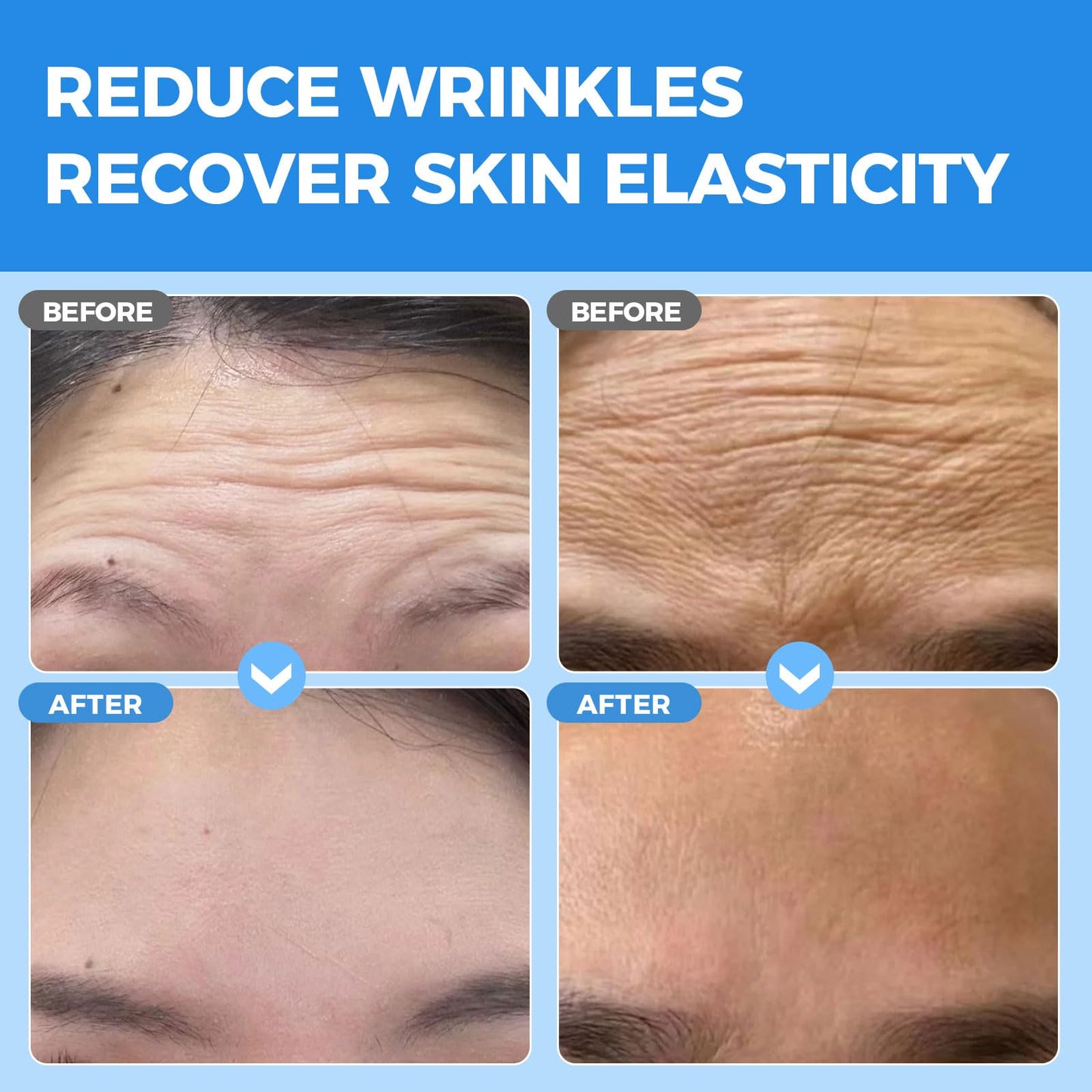 Okela Forehead Wrinkle Patches Overnight 20 pcs with Collagen, Anti Wrinkle Patches, Forehead Wrinkles Beauty Treatment Beauty and Personal Care Okela