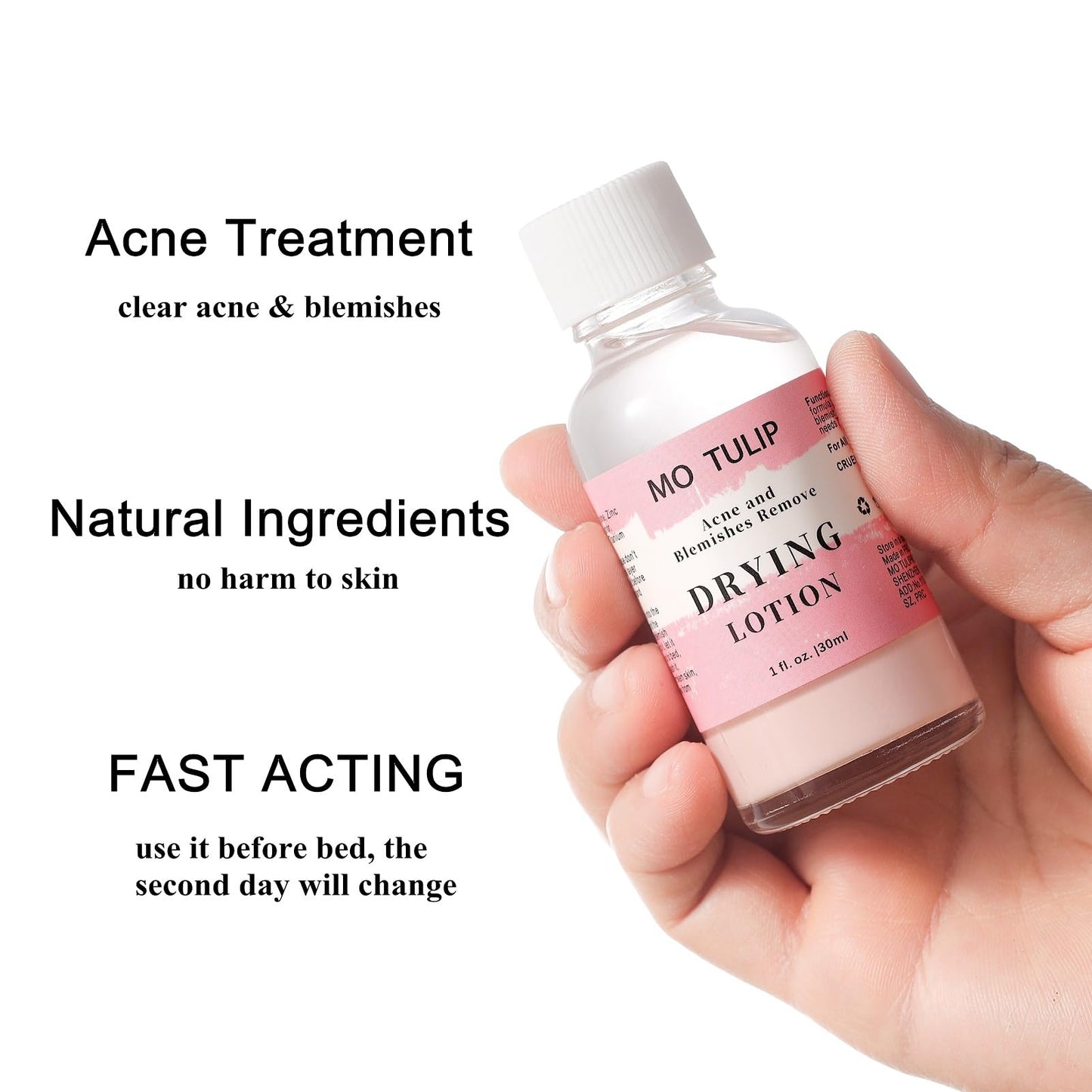 MO TULIP Acne Drying Lotion, Overnight Acne Acid and Acne Spot Treatment for Face and Body, Pimple Lotion Spot Treatment, Dry Out Pimples, Blemishes