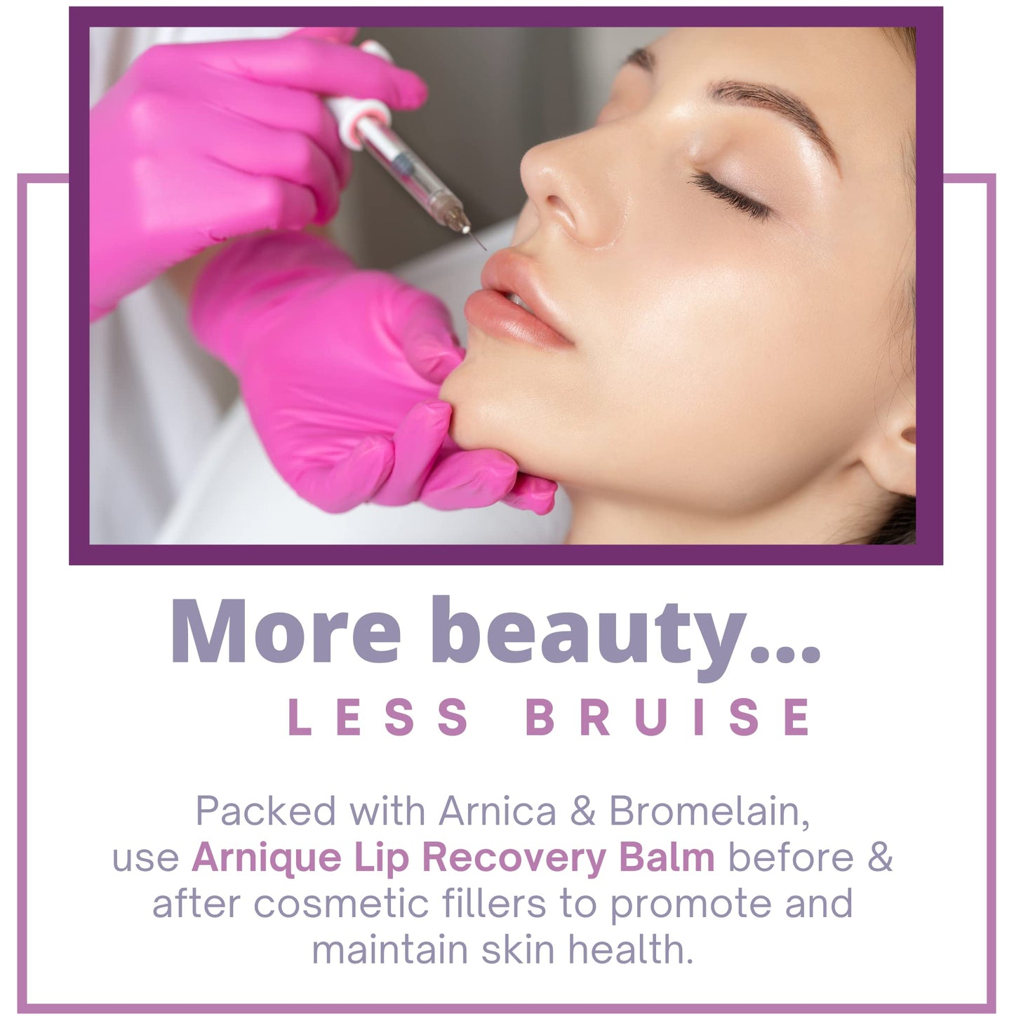 Arnique Arnica Lip Balm - Lip Filler Aftercare Balm with Arnica Montana and Bromelain, Soothing Topical Masque for Lip Flip, Injections, and Cosmetic