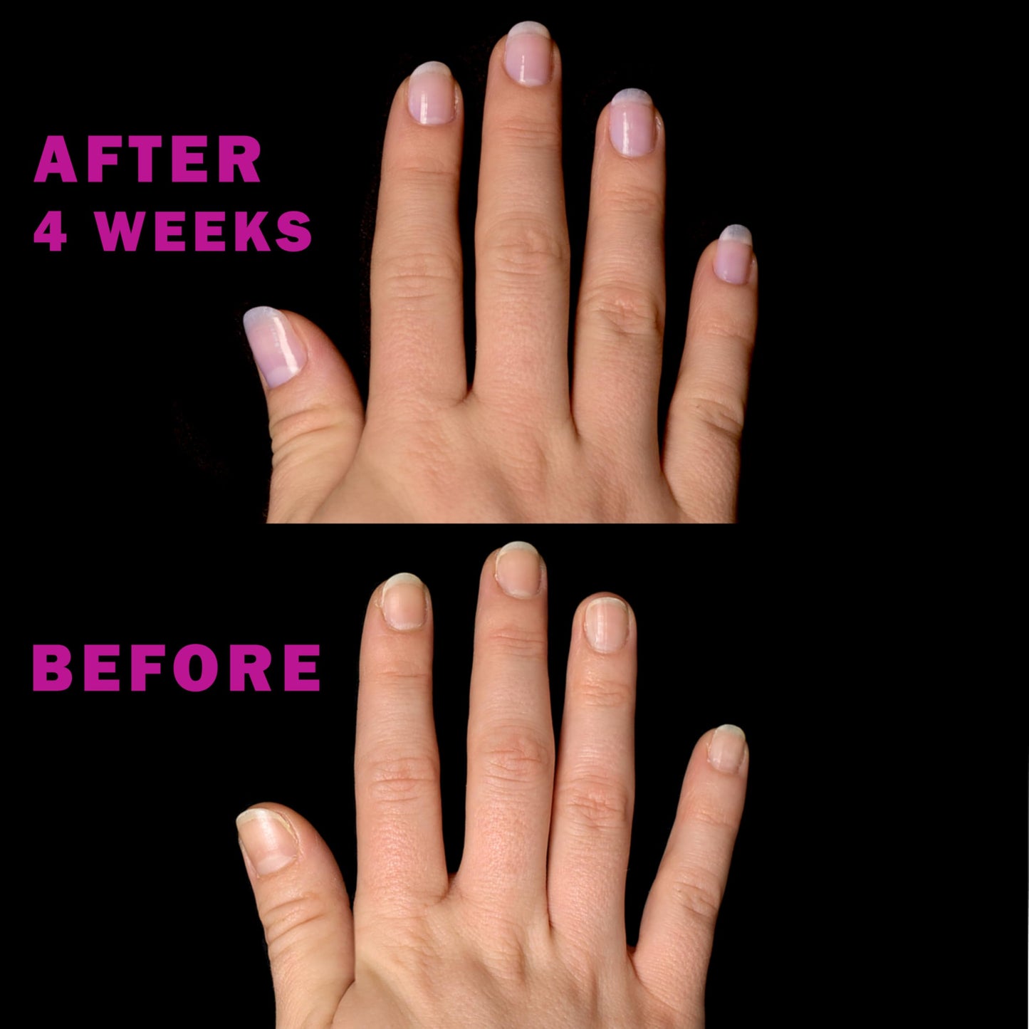 Perfect Formula Pink Gel Coat - Rosey Glow Nail Strengthener & Keratin Treatment, 0.6 oz - Protein-Rich, Glossy Pink Gel Nail Polish for Damaged Nails