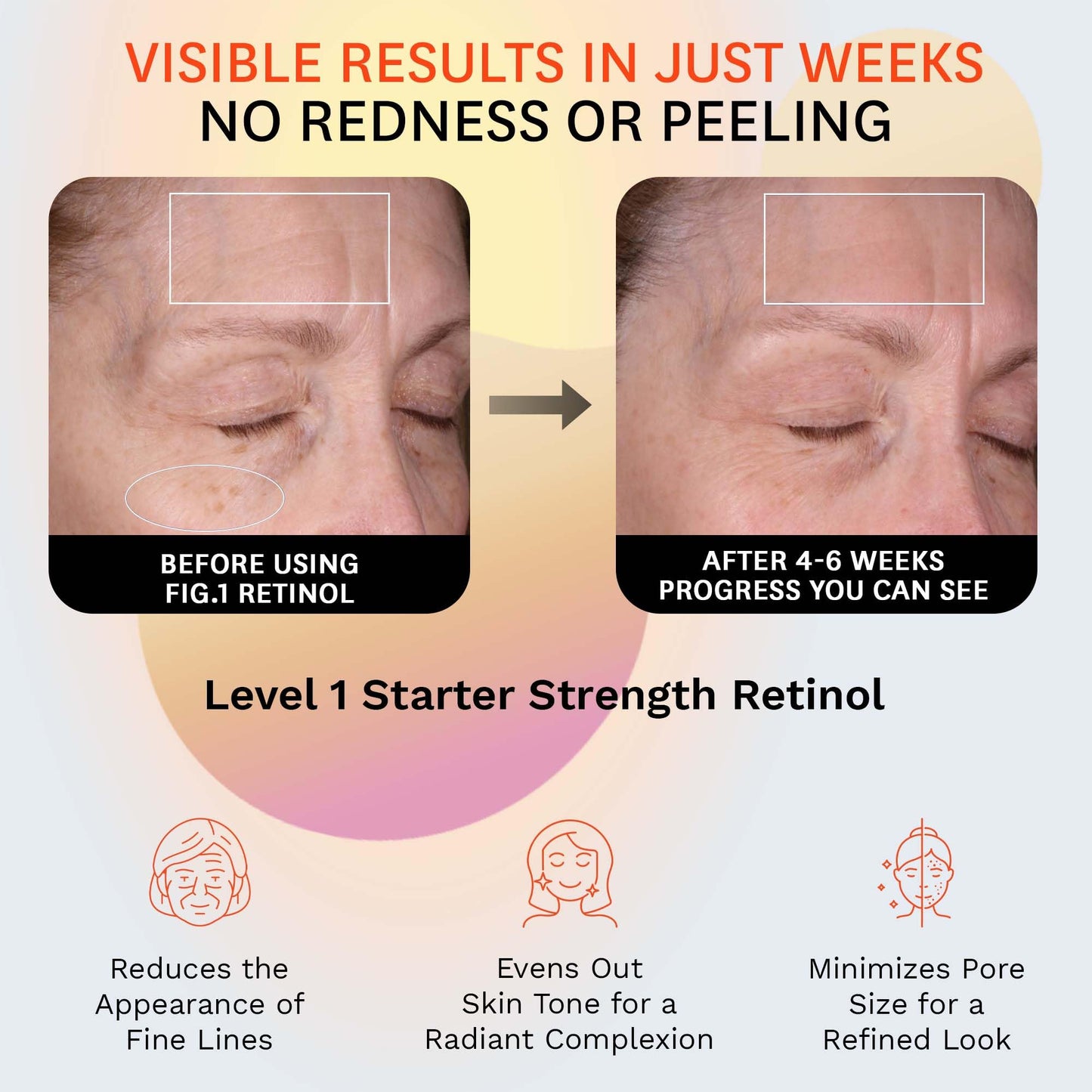 Fig.1 Retinol Night Cream | Face Hydrating Moisturizer With Retinol & Squalane | Night Cream For Women With Sensitive Skin | Dermatologist Tested